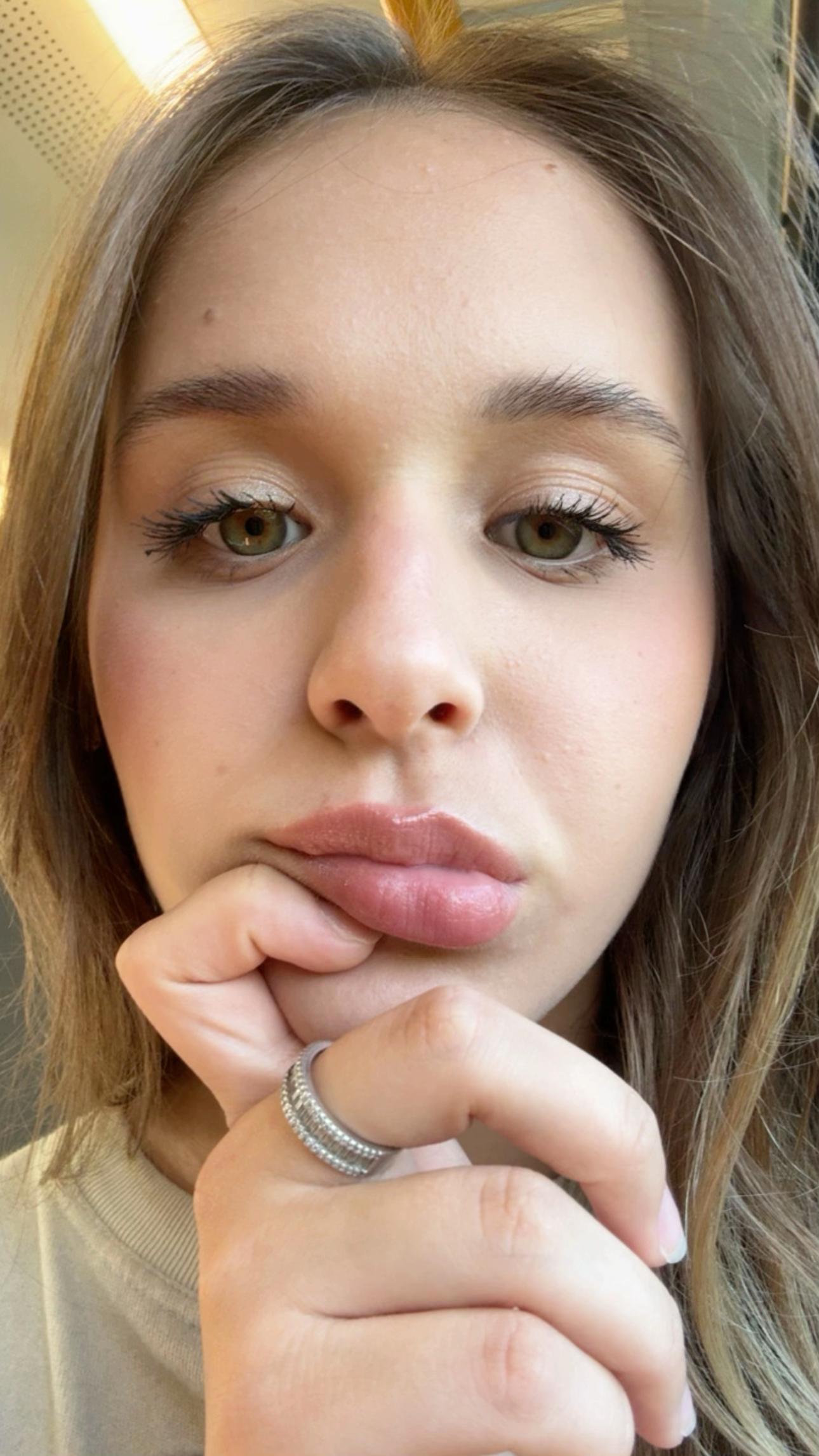 @💋