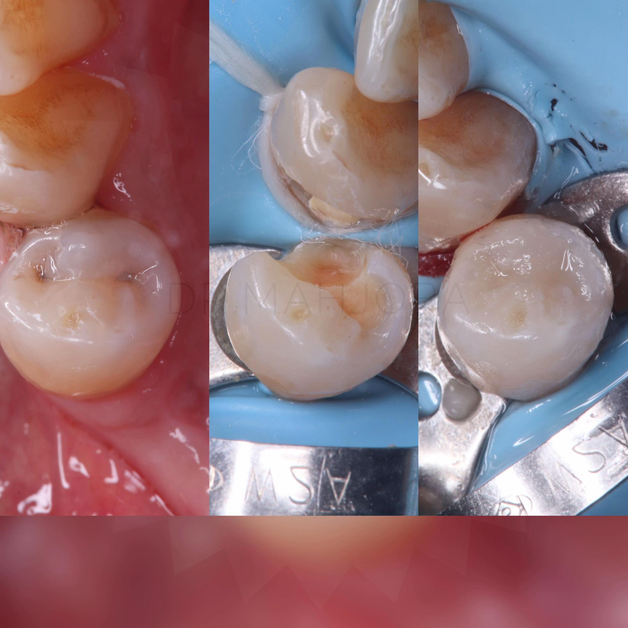 @Dr.Noor Mahjoba👩🏻⚕️🦷💉💎