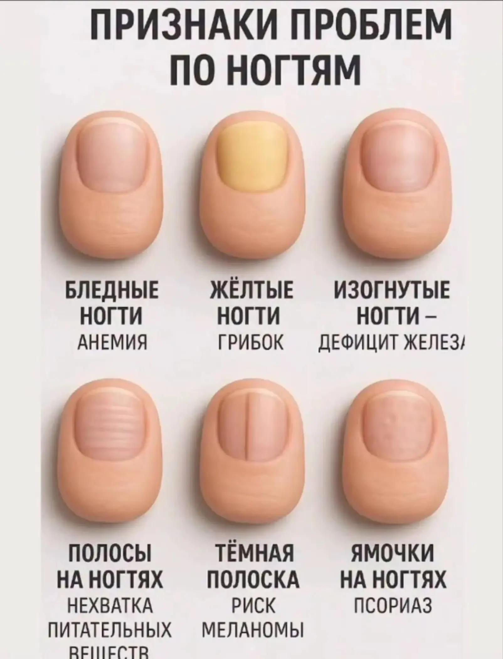 @@8ALEHA8@