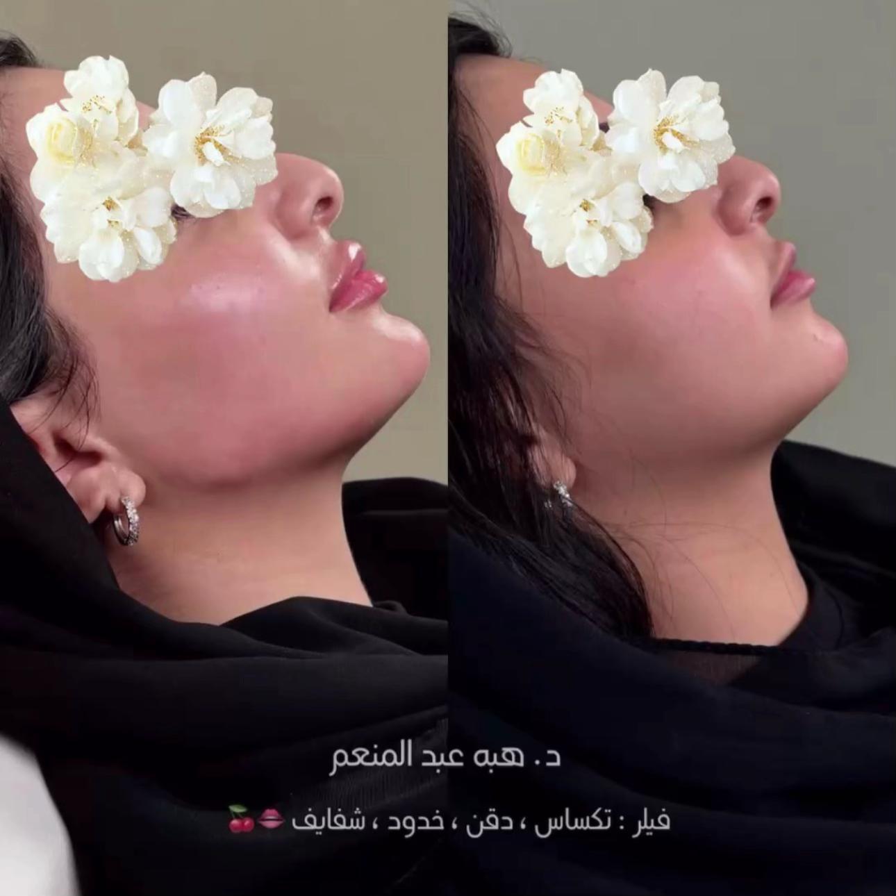 @مزدانه (فرع الملك عبدالله)