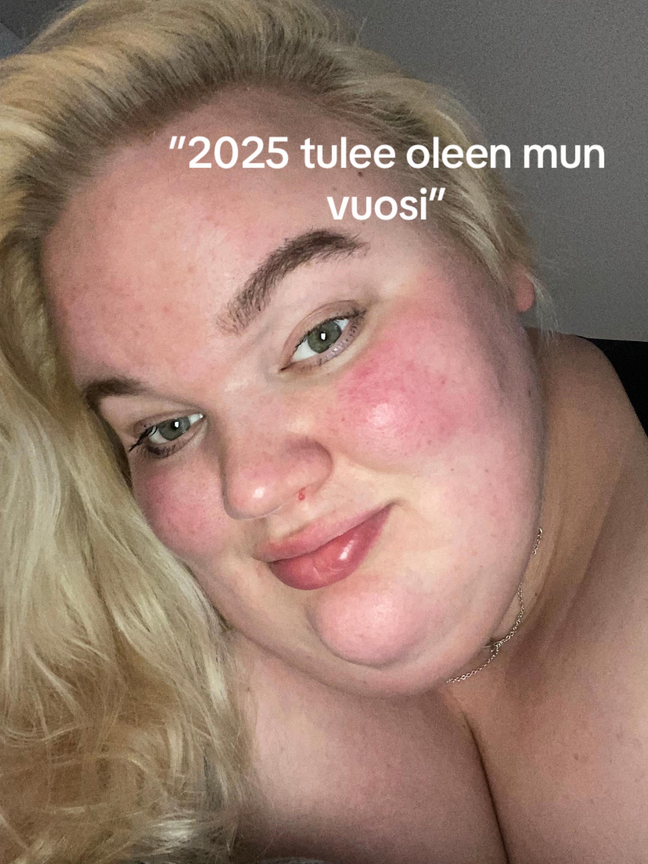 @Olga