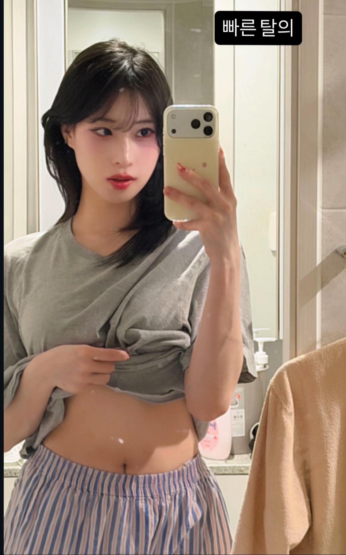 @IRENE🐰✨