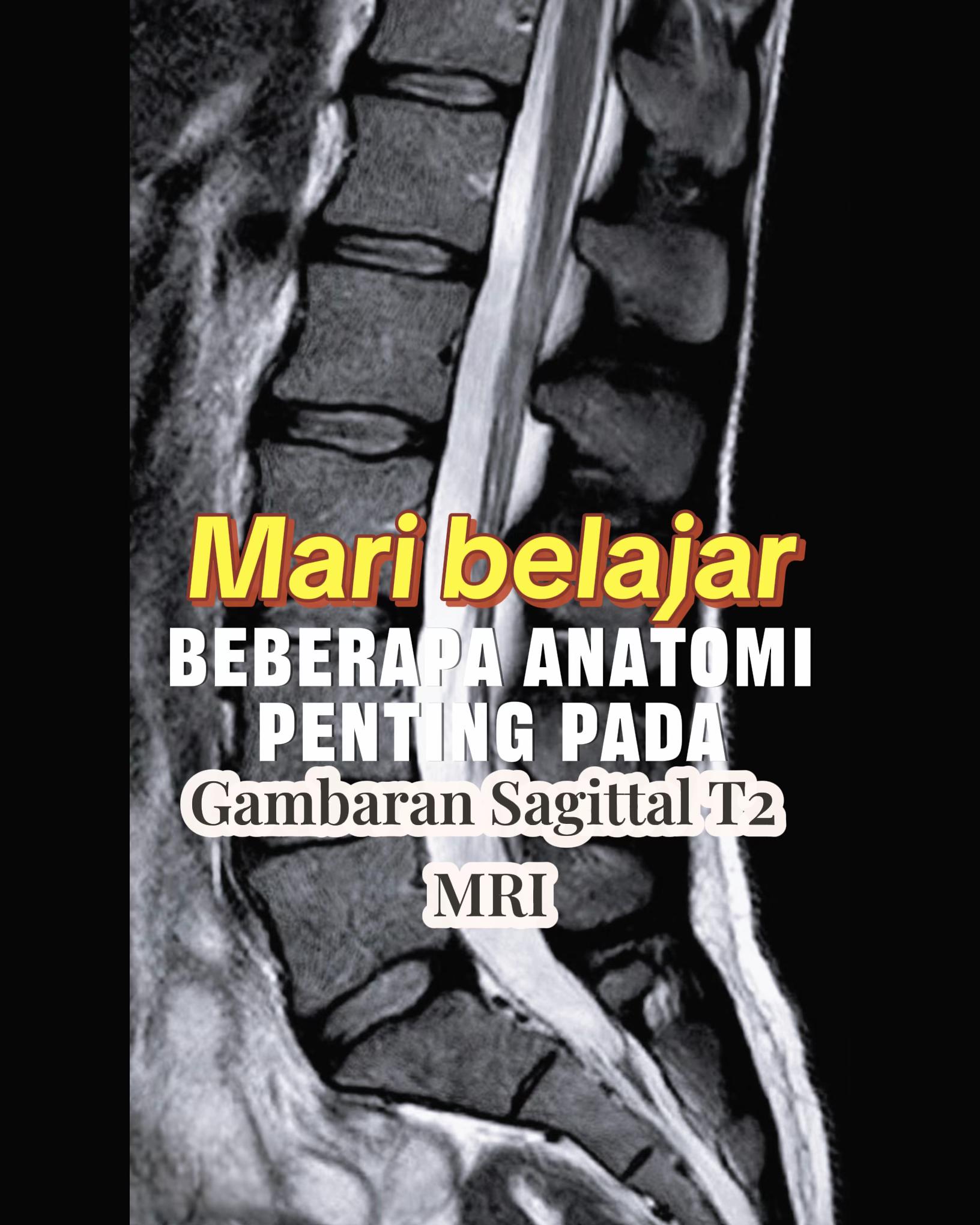 @Sobat Radiology