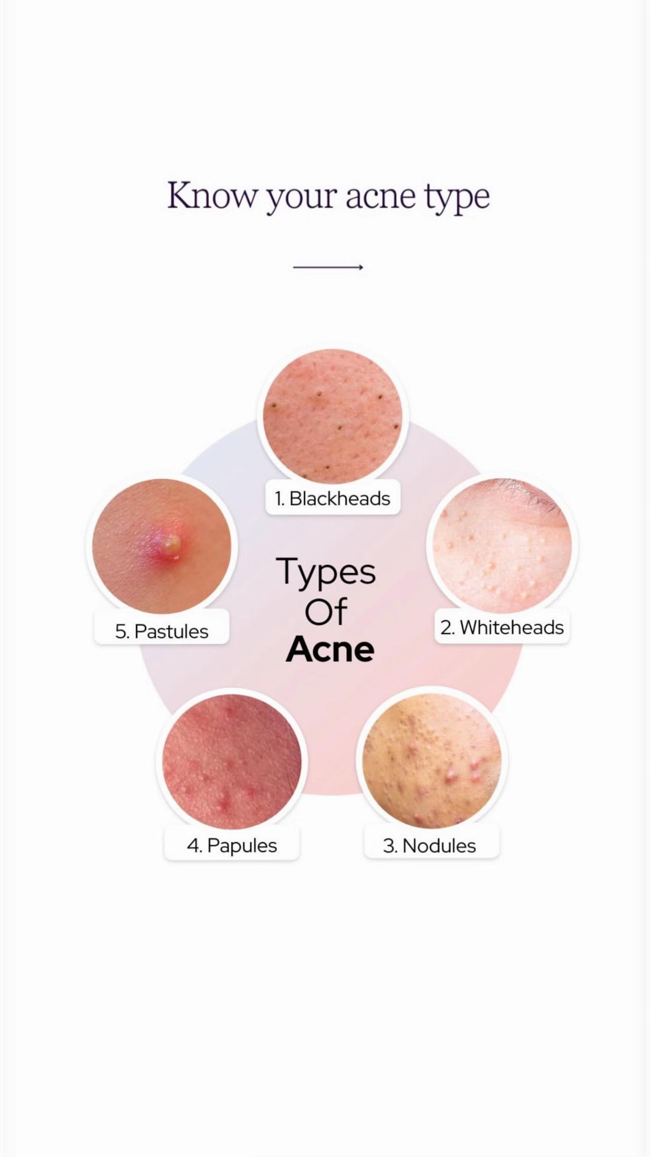 @Gielyskincare