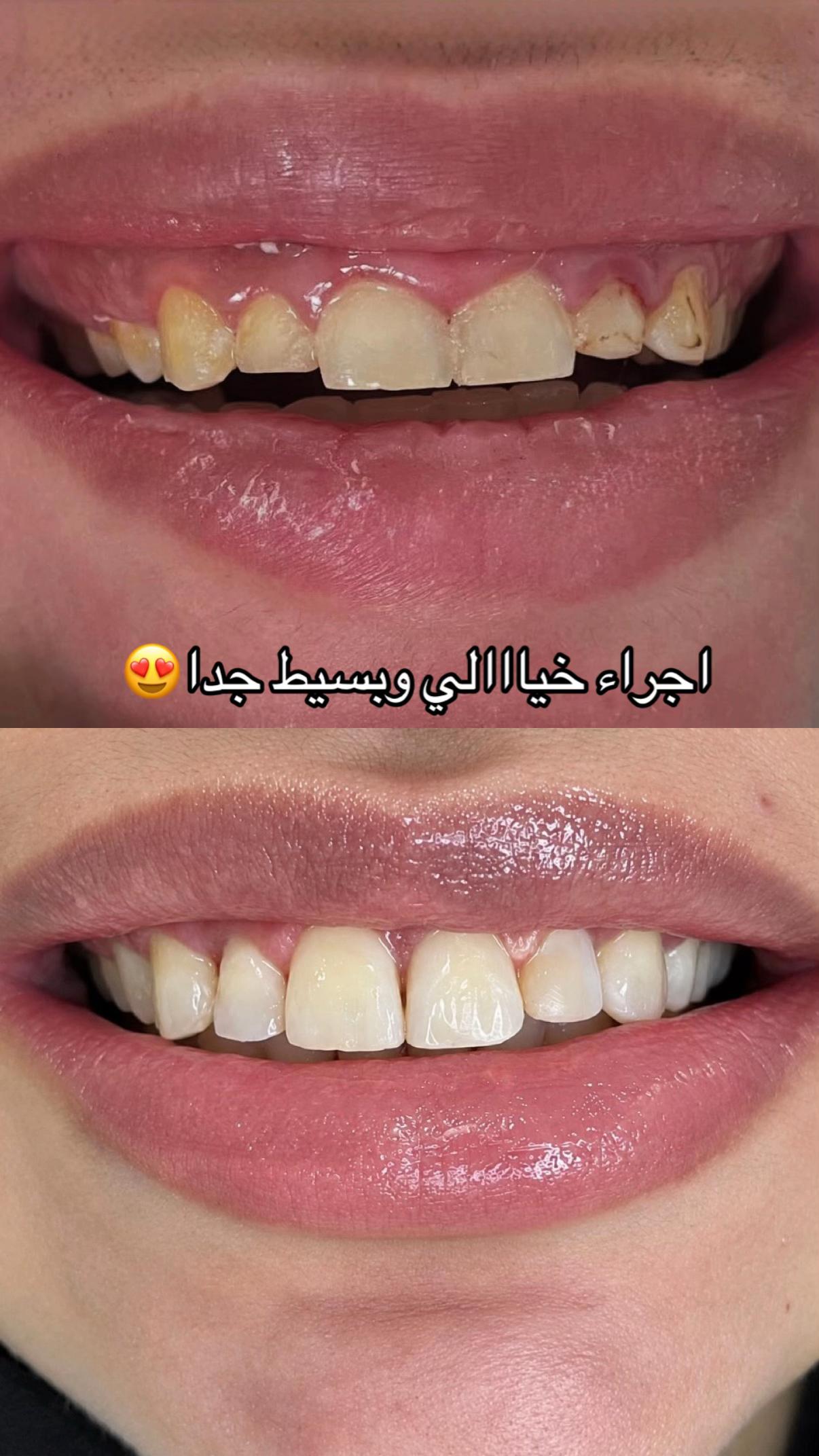 @د/ عائشة الطحامي