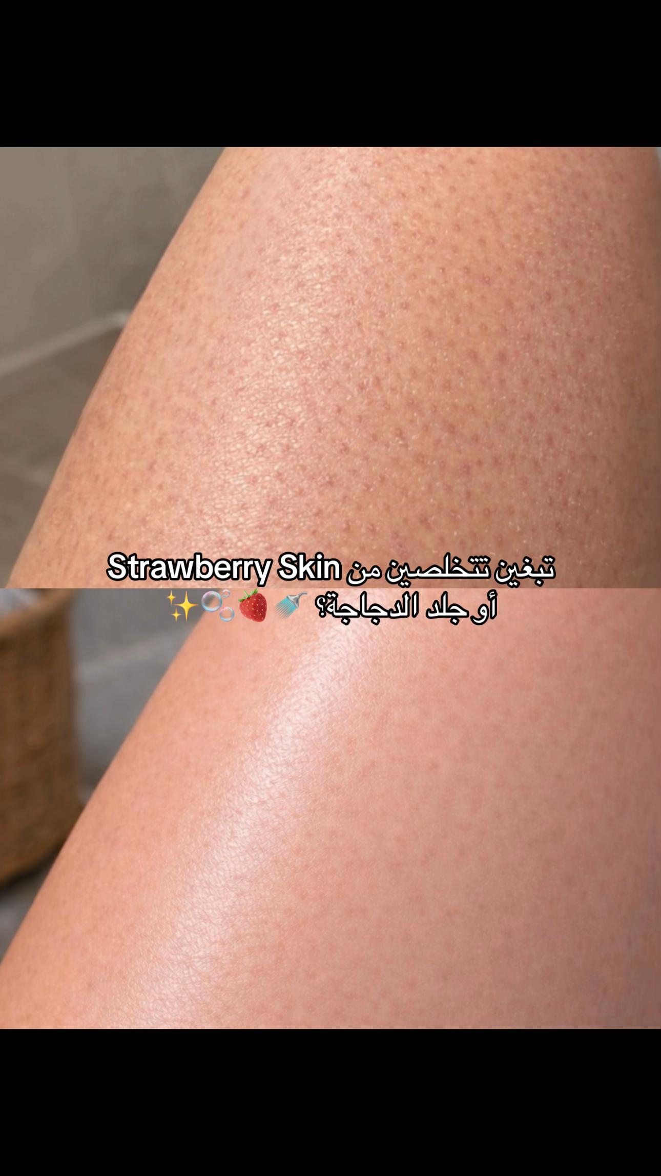 @شيماء الحربي🍒