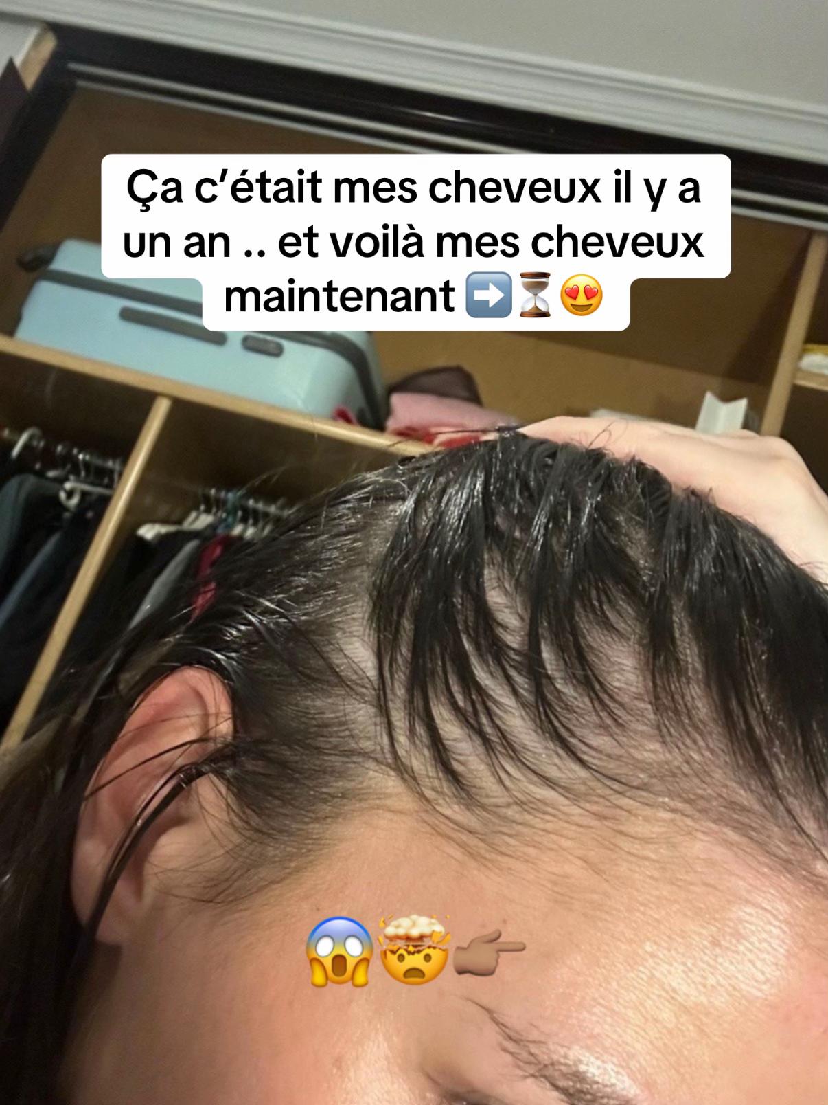 @Lux’Hair Growth FR