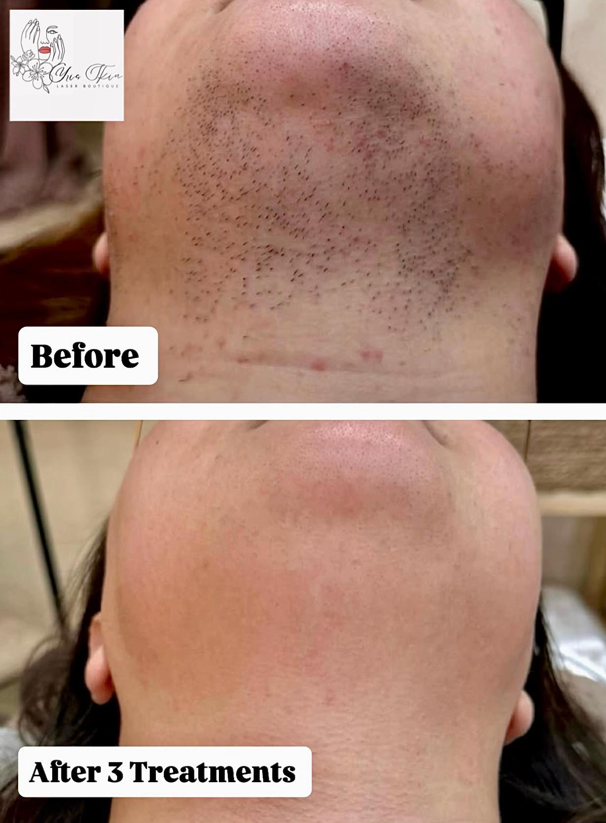 @Yris Skin Laser Boutique Delta