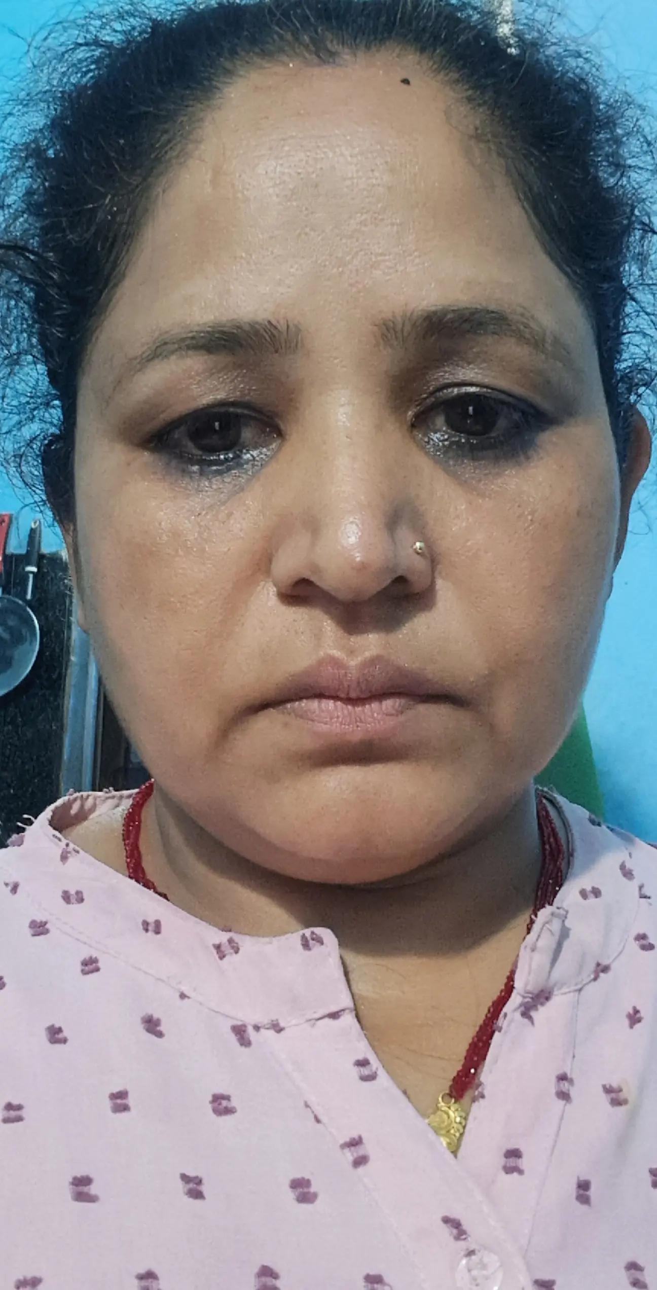 @chandika mainali