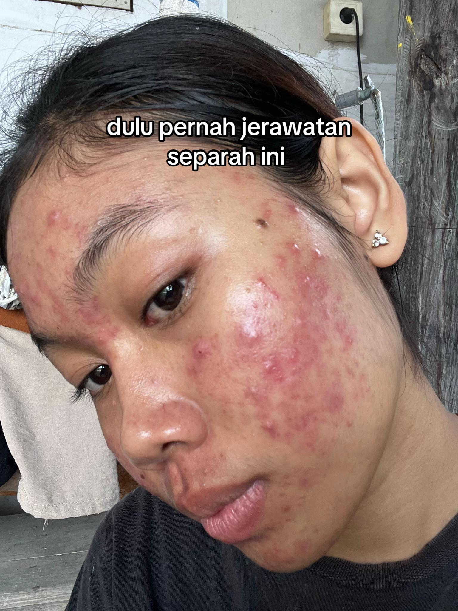 @Nina Marselina