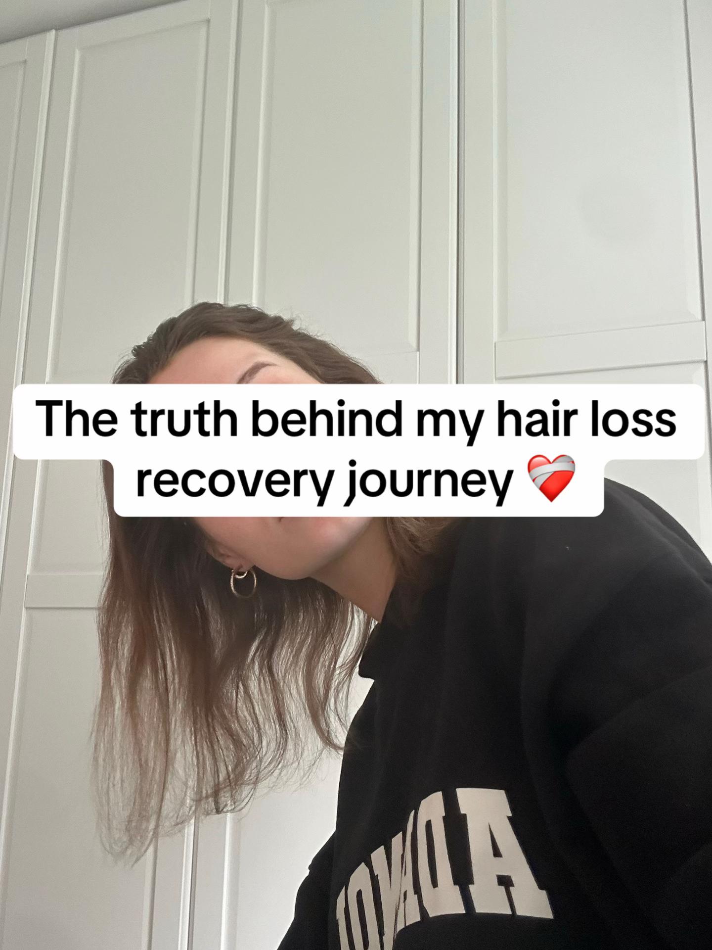 @Hairlossdiva