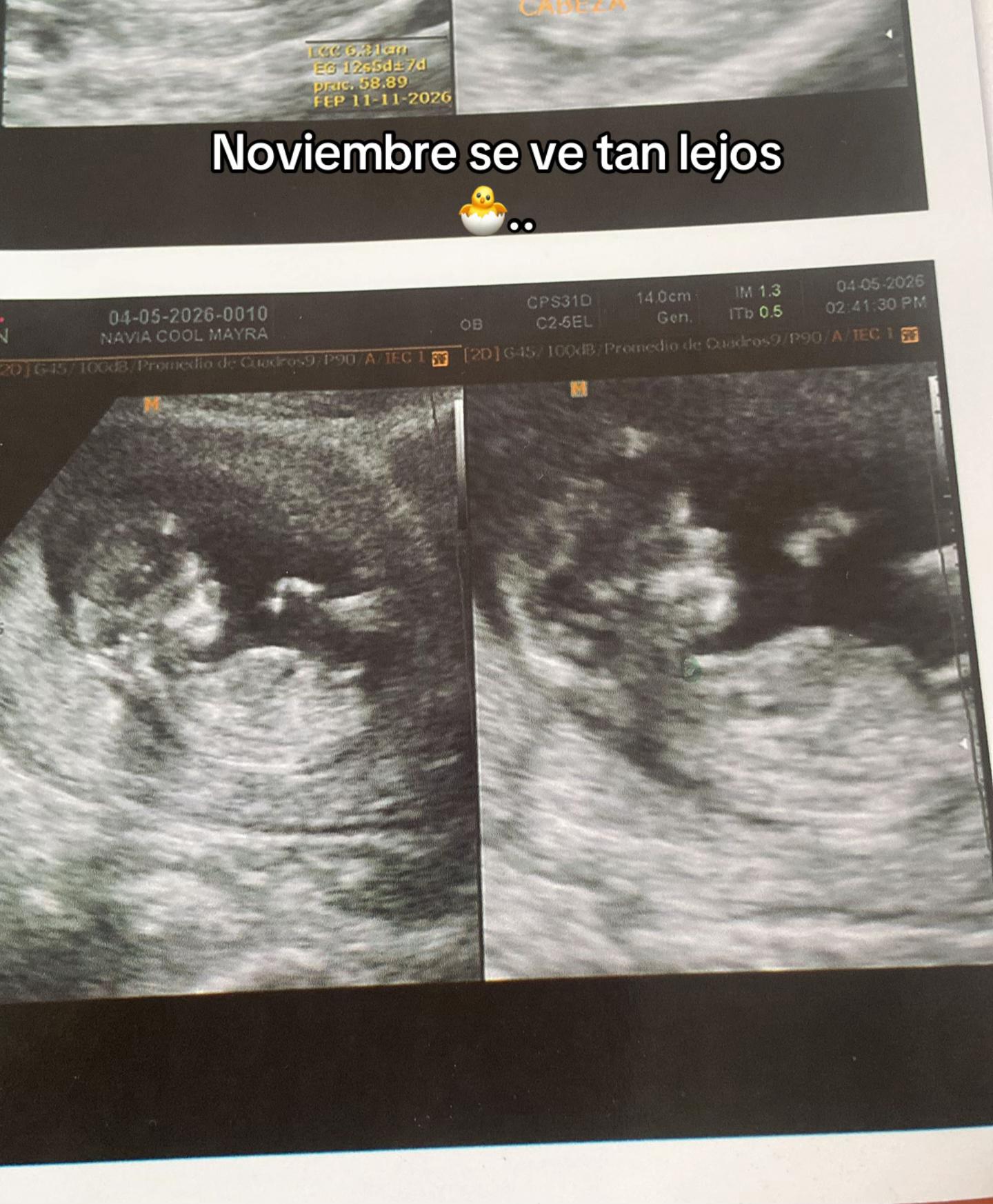 @Alejandra Navia🤎