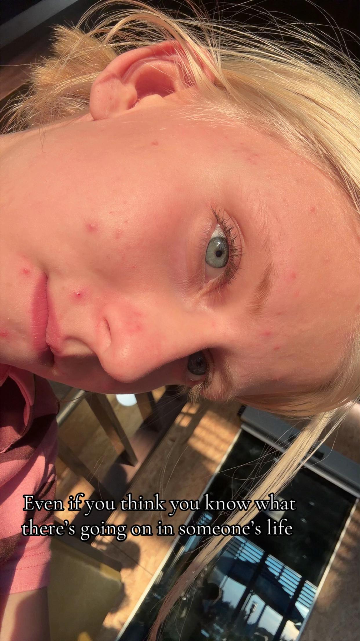 @ida_elisabeth0