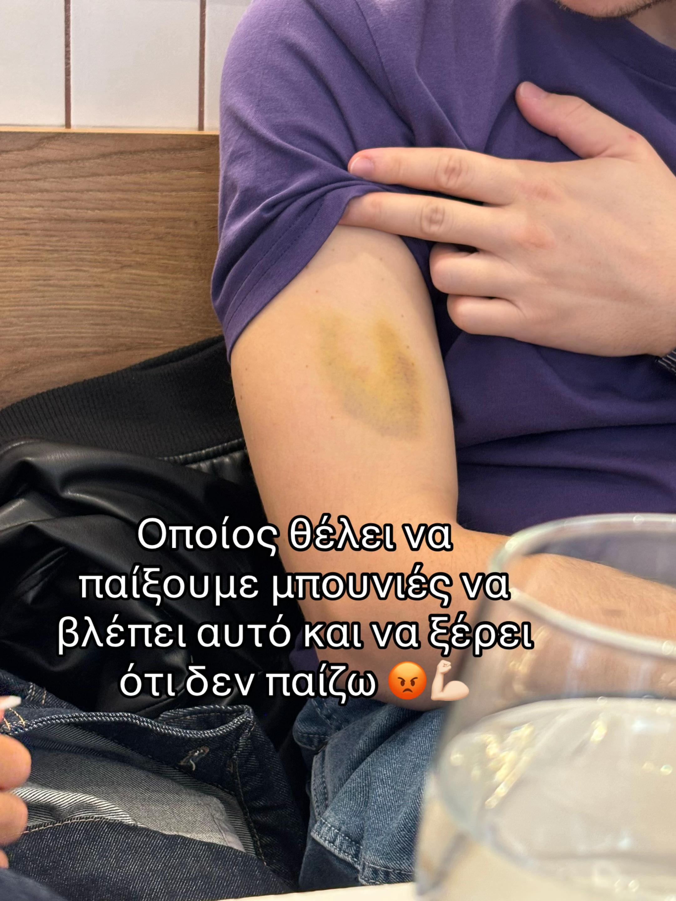 @An&delta;ri