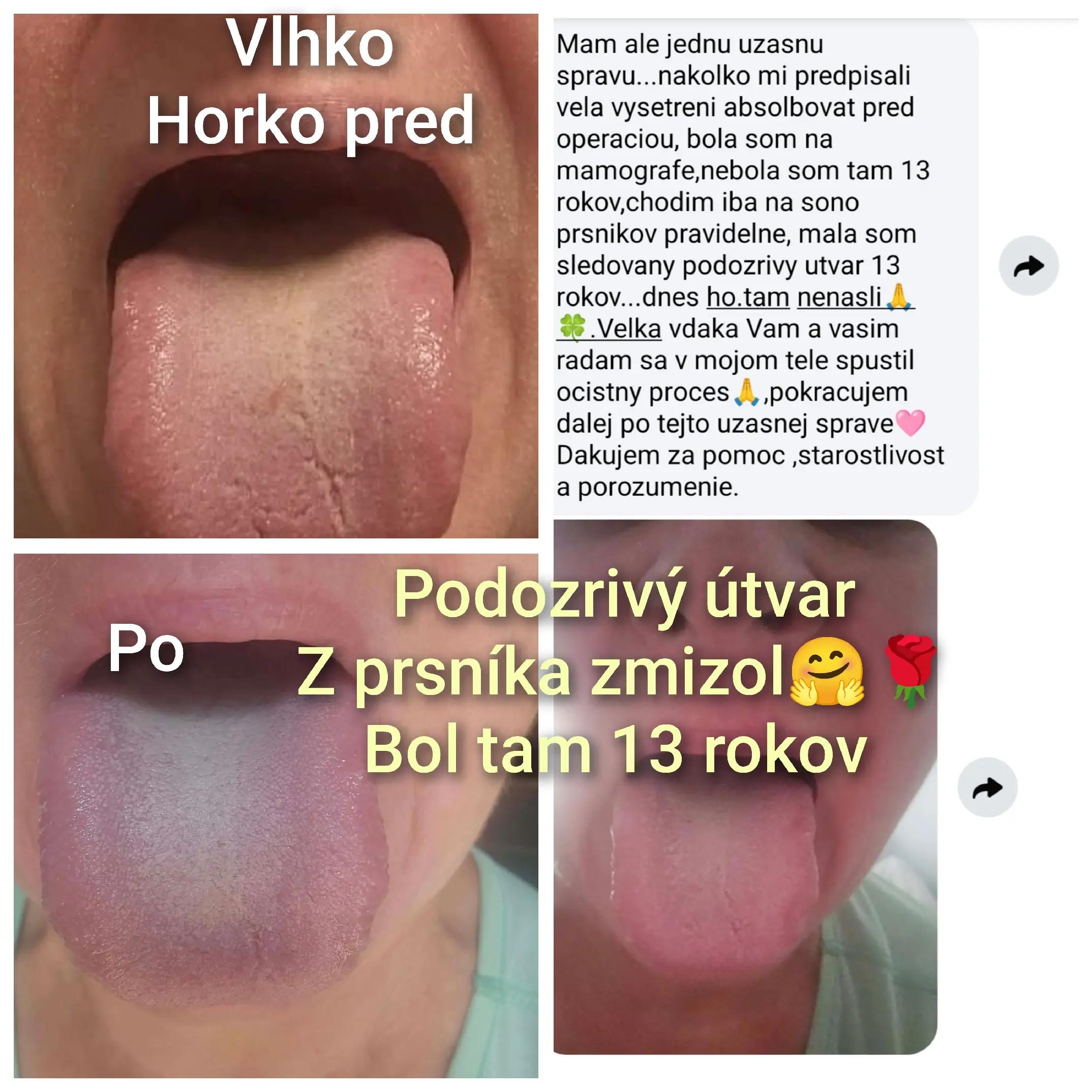 @samoliečenie