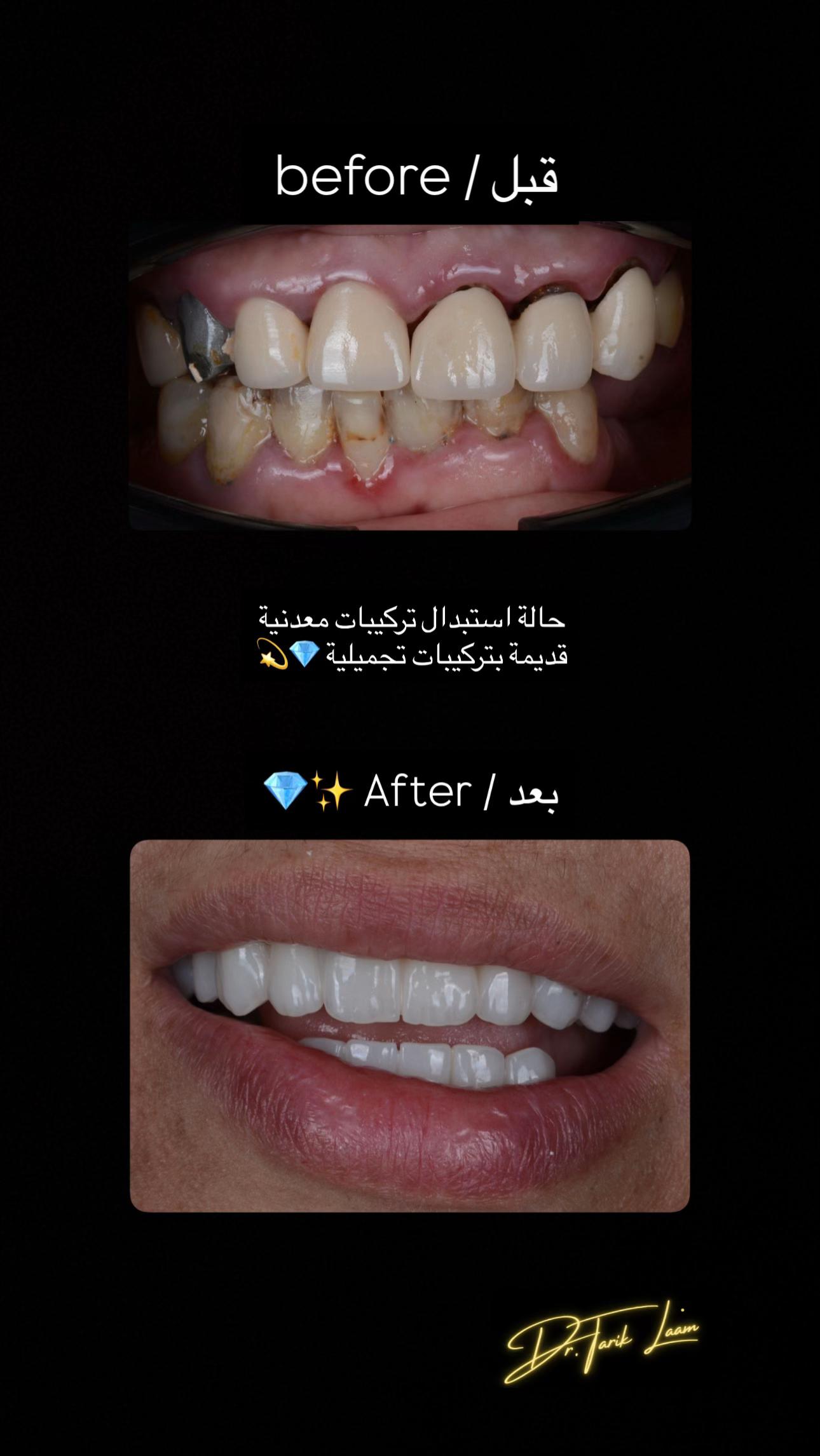 @Dr.tarik_laam