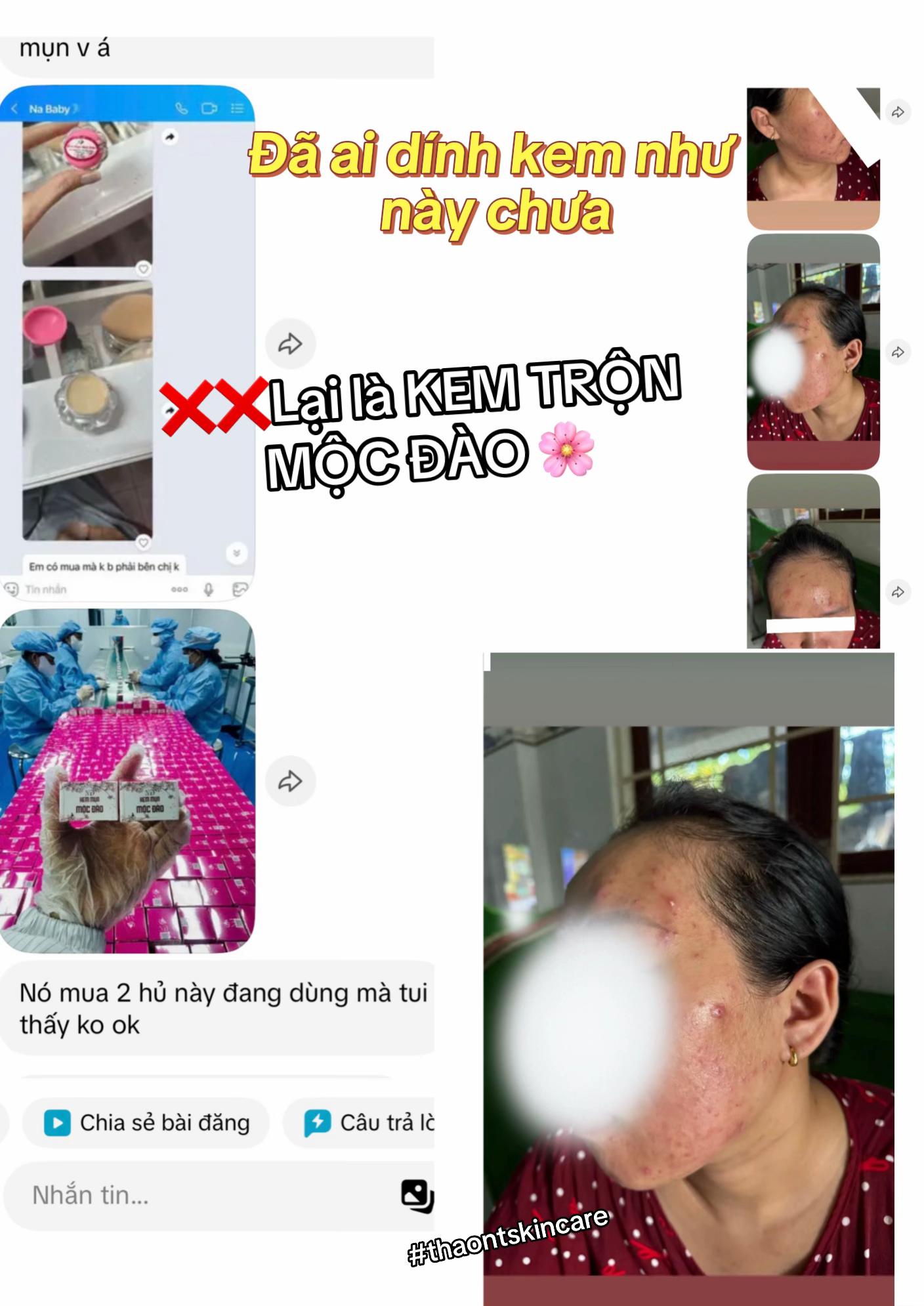 @Thảo NT Skincare