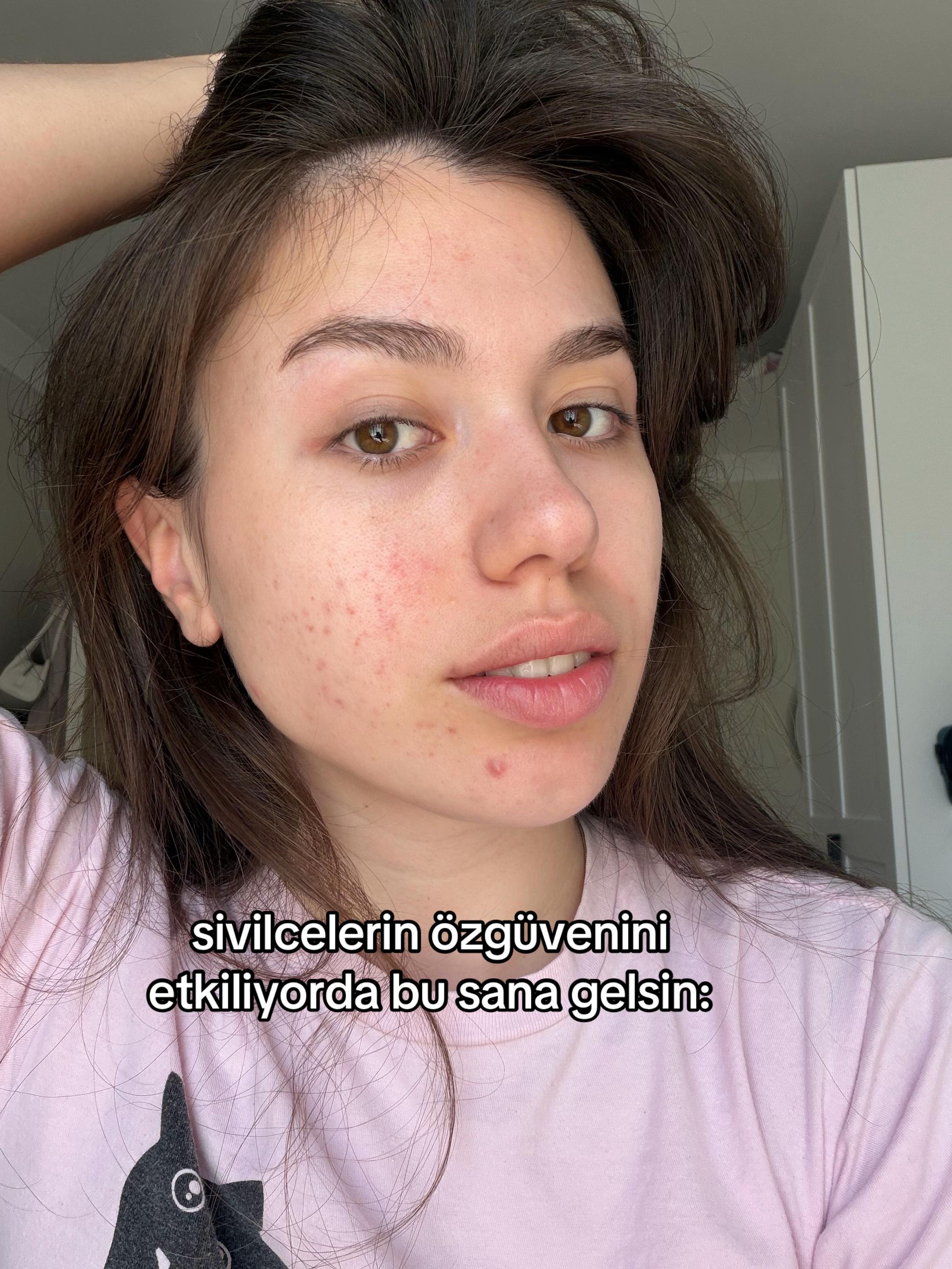 @Badesim ❤️🔥