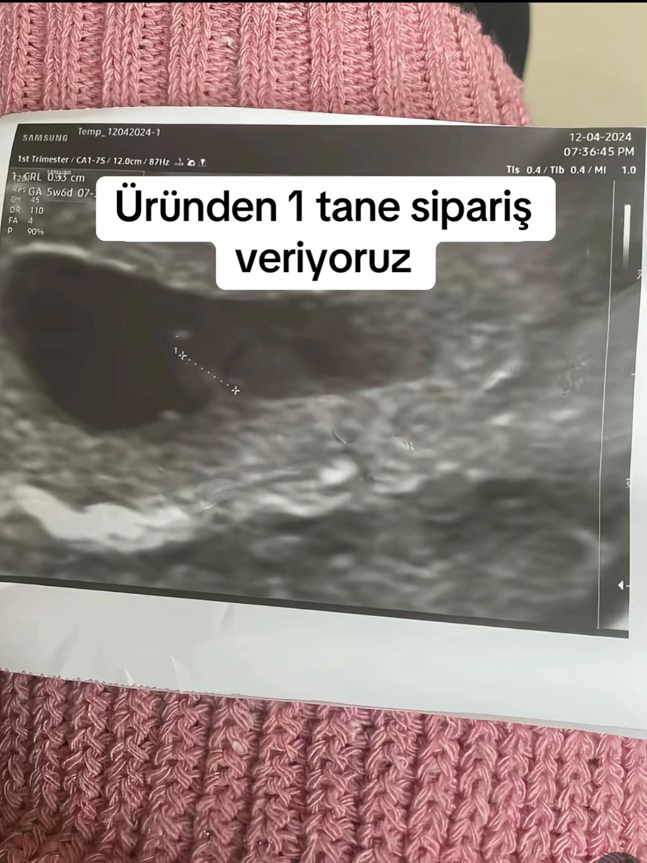 @İroşşş ve ikizlerin.günlüğü