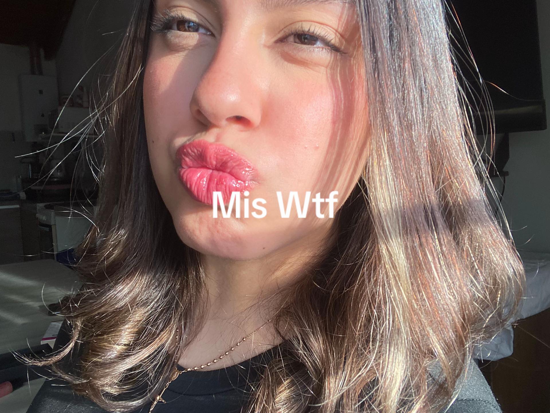 @zoee.scabuzzooo