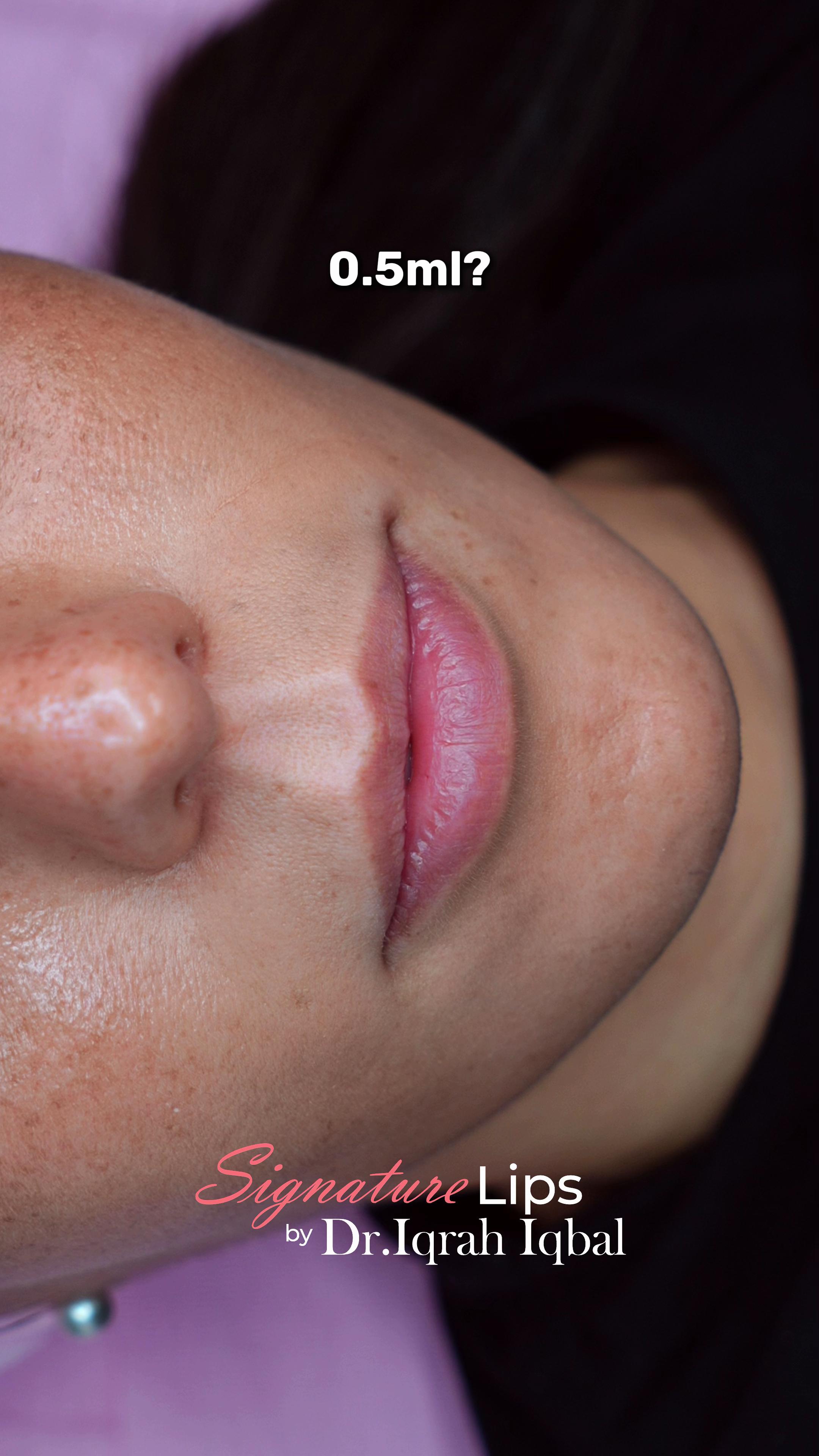 @Dr.Iqrah.Aesthetics