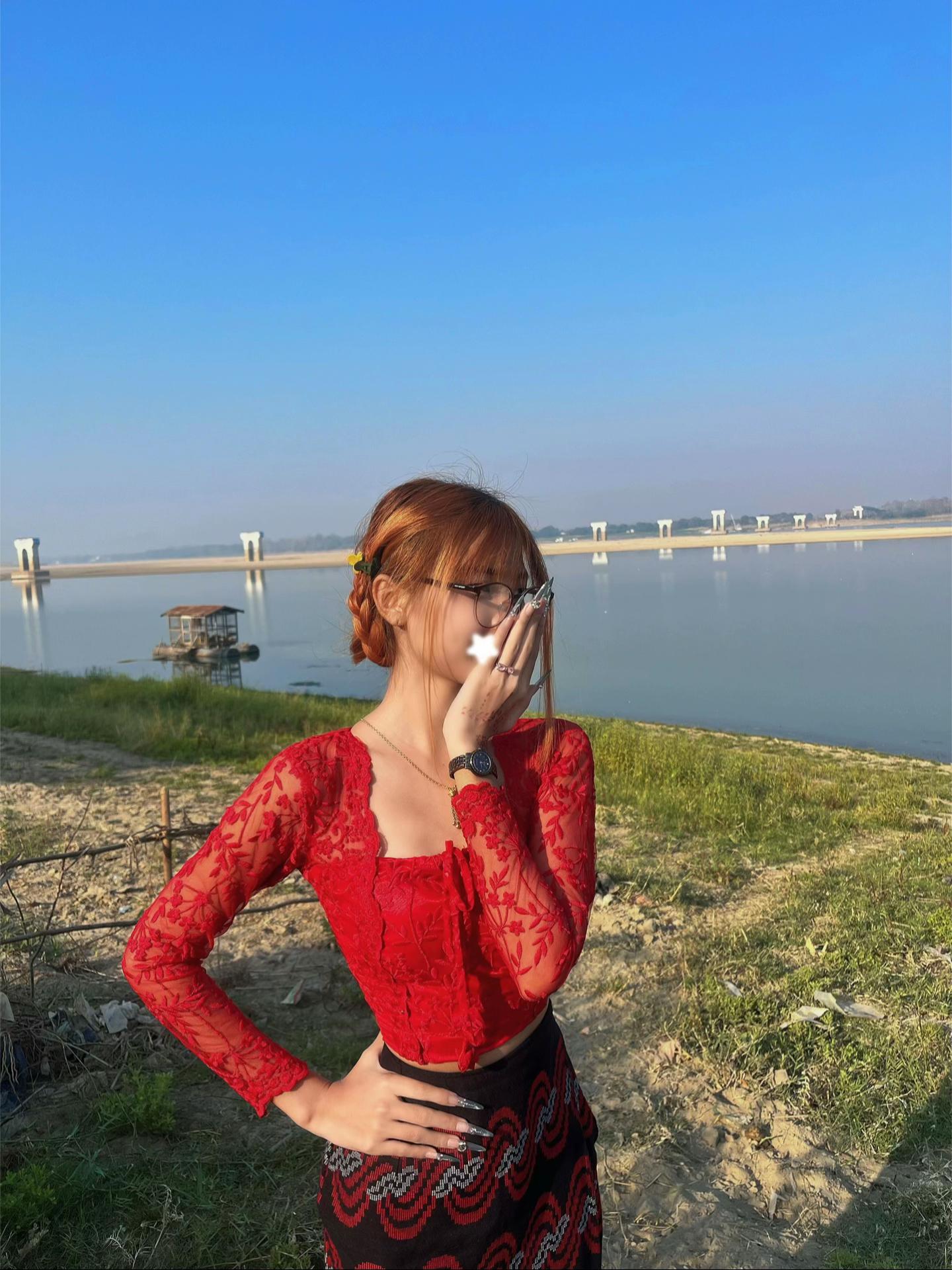 @eiei