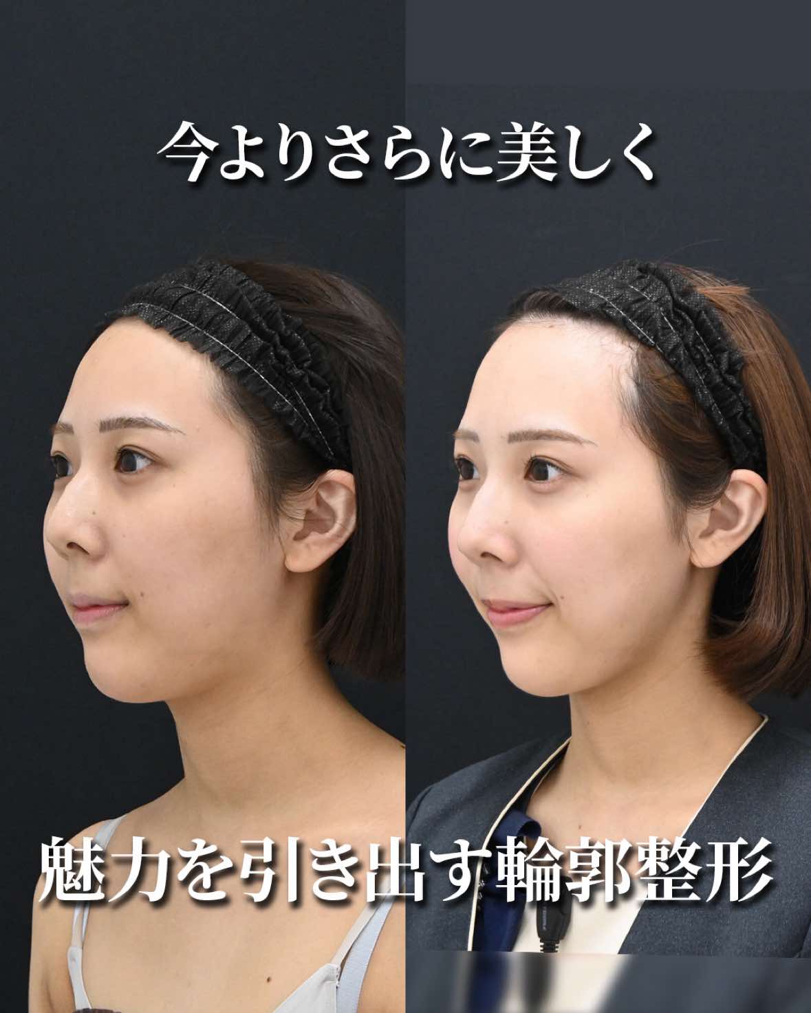 @名倉俊輔 輪郭.若返りの美容外科
