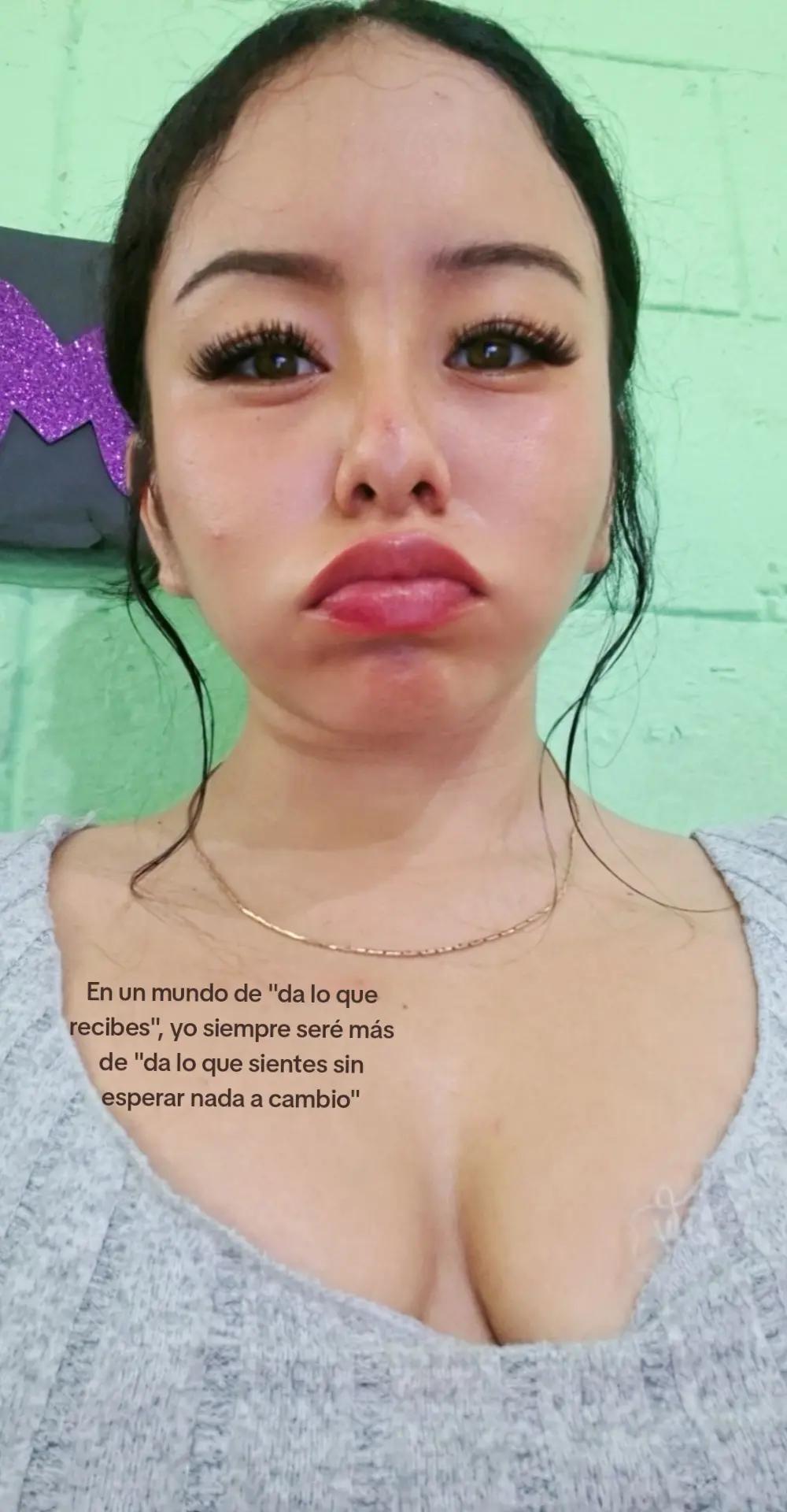 @Emelyn