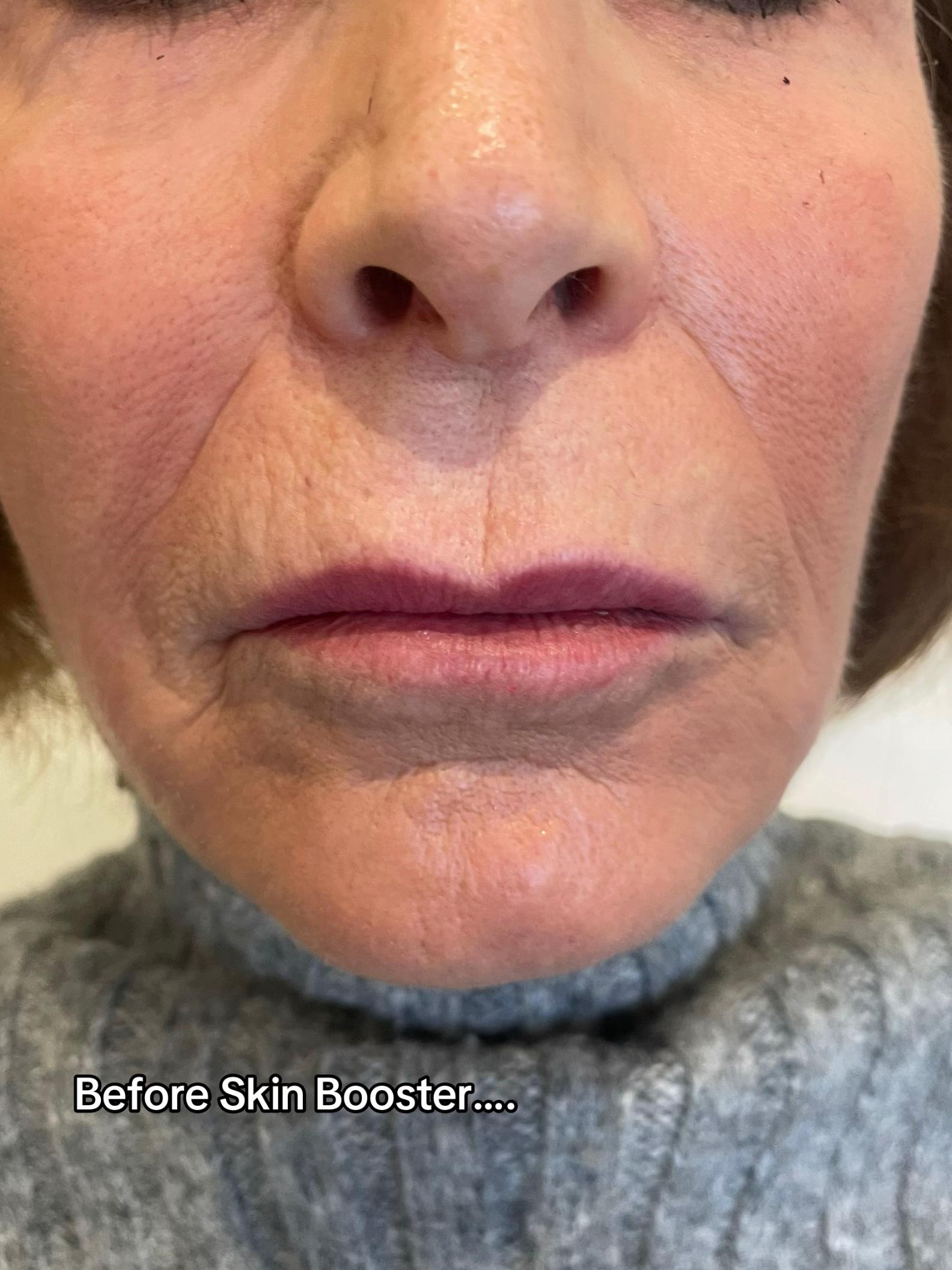 @Brows & Aesthetics by Lou