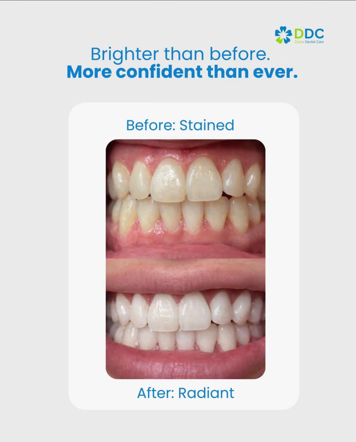 @Diana Dental Care