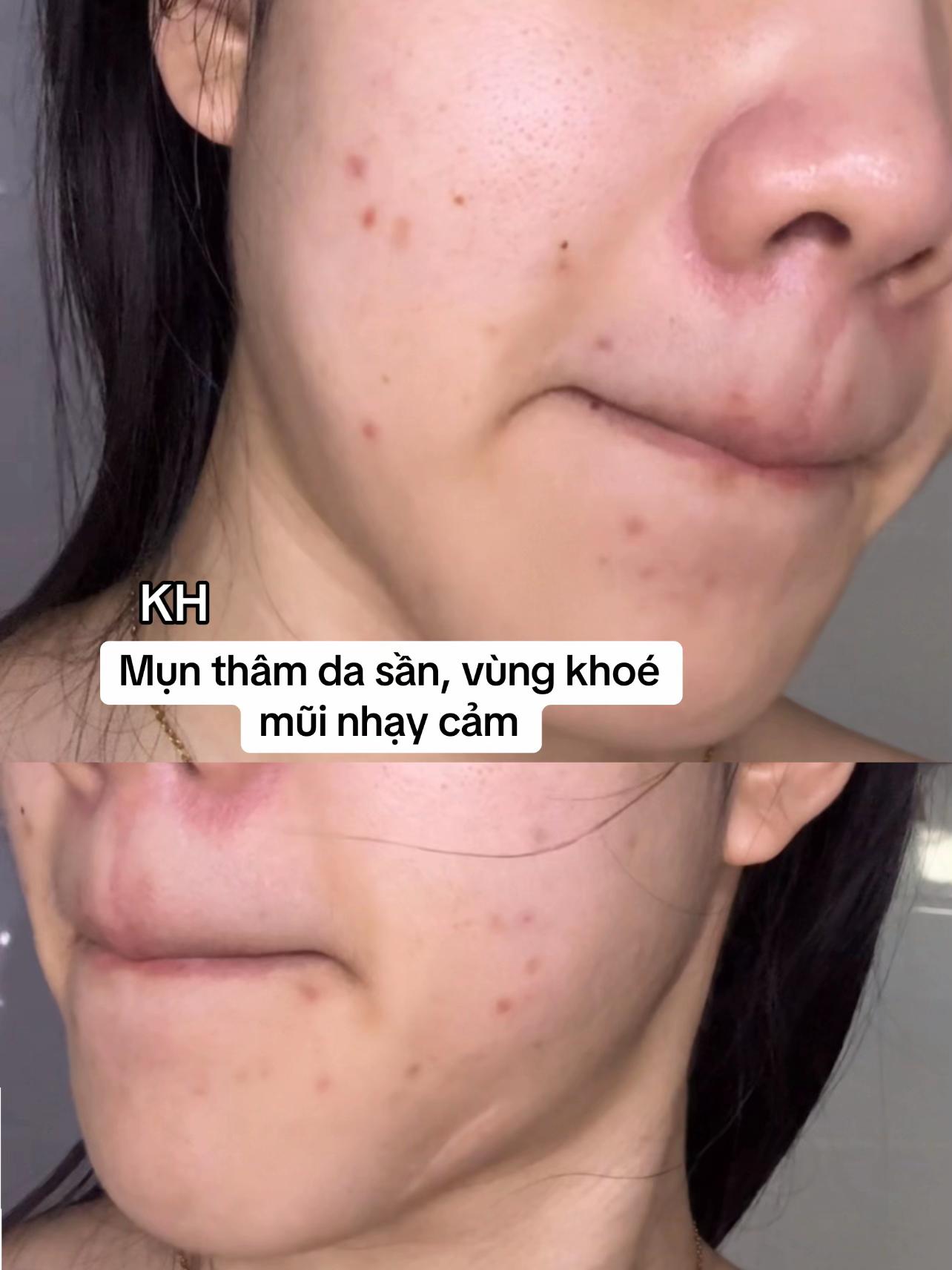 @Thảo NT Skincare