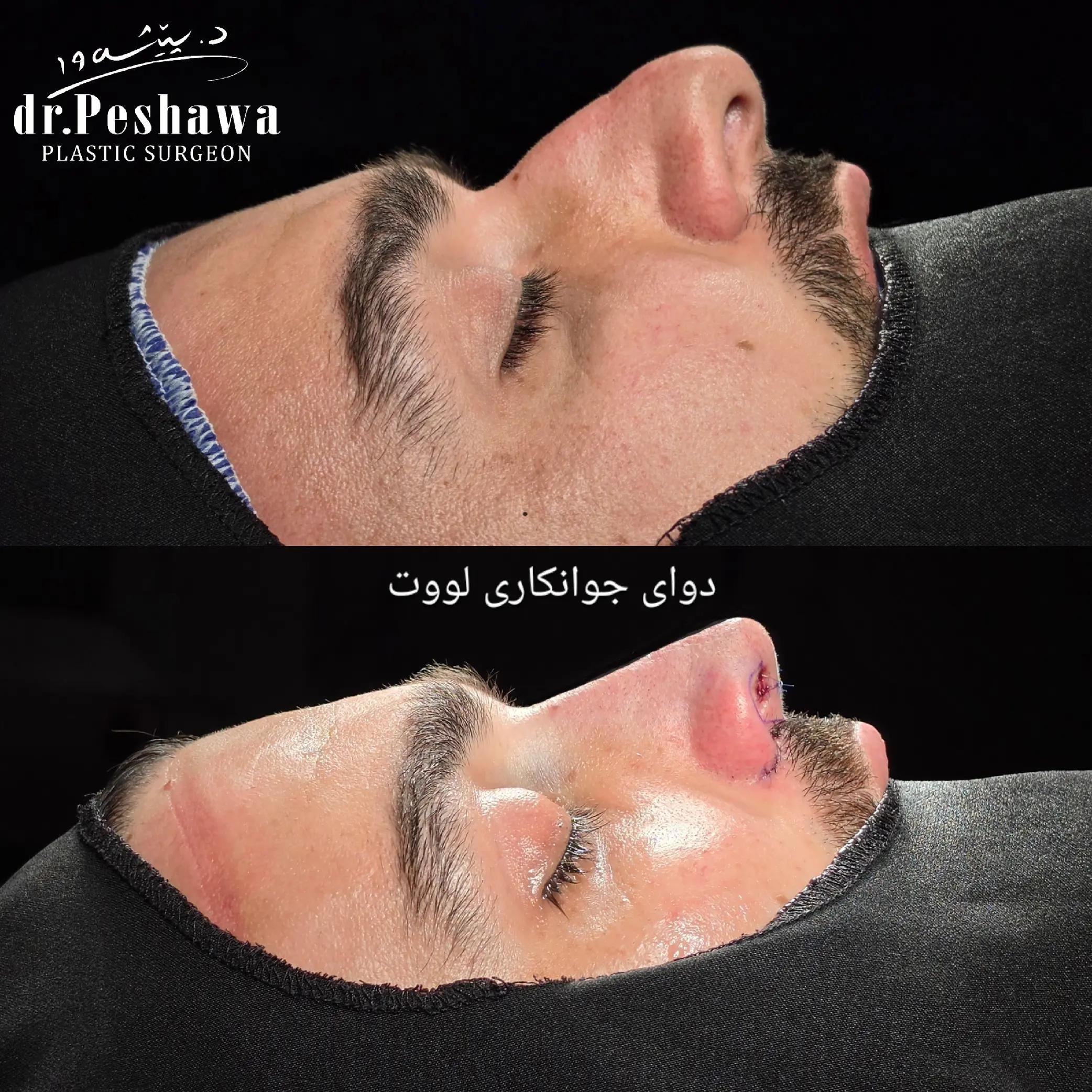 @Dr. Peshawa Plastic Surgeon