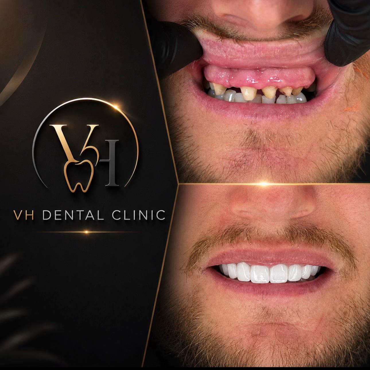 @drveton