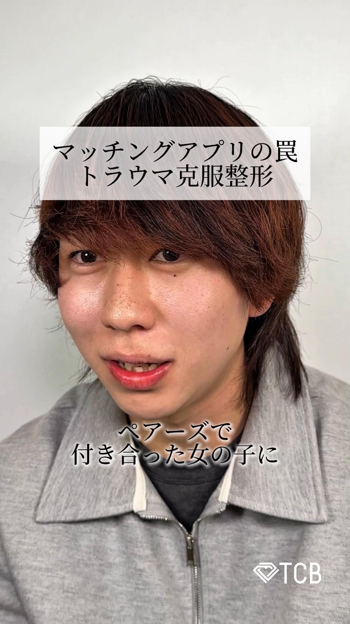 @【二重整形】TCB 新宿東口院ゆいこ先生/東京