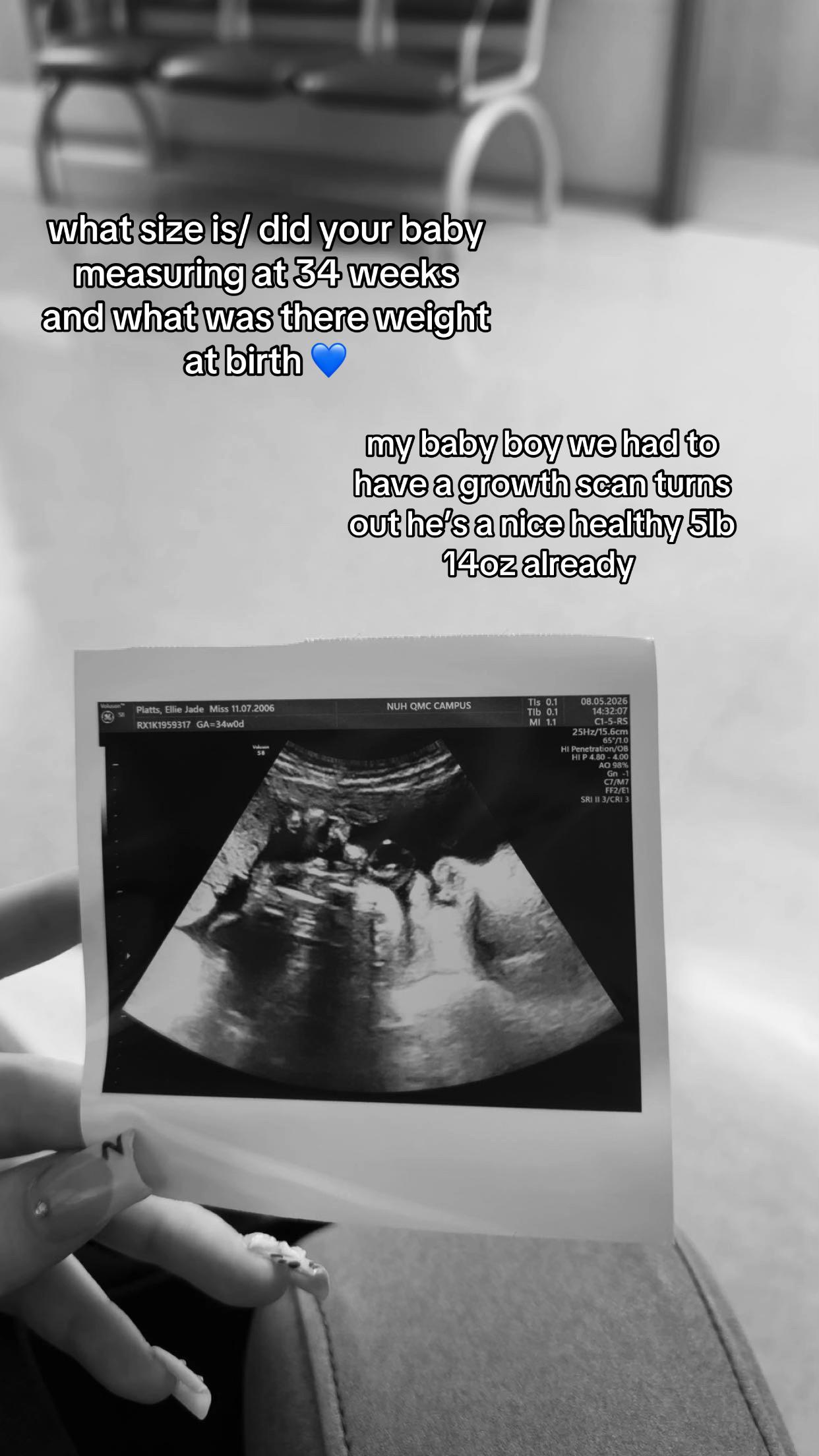 @ells 🍒 |mommy to be 👶💙