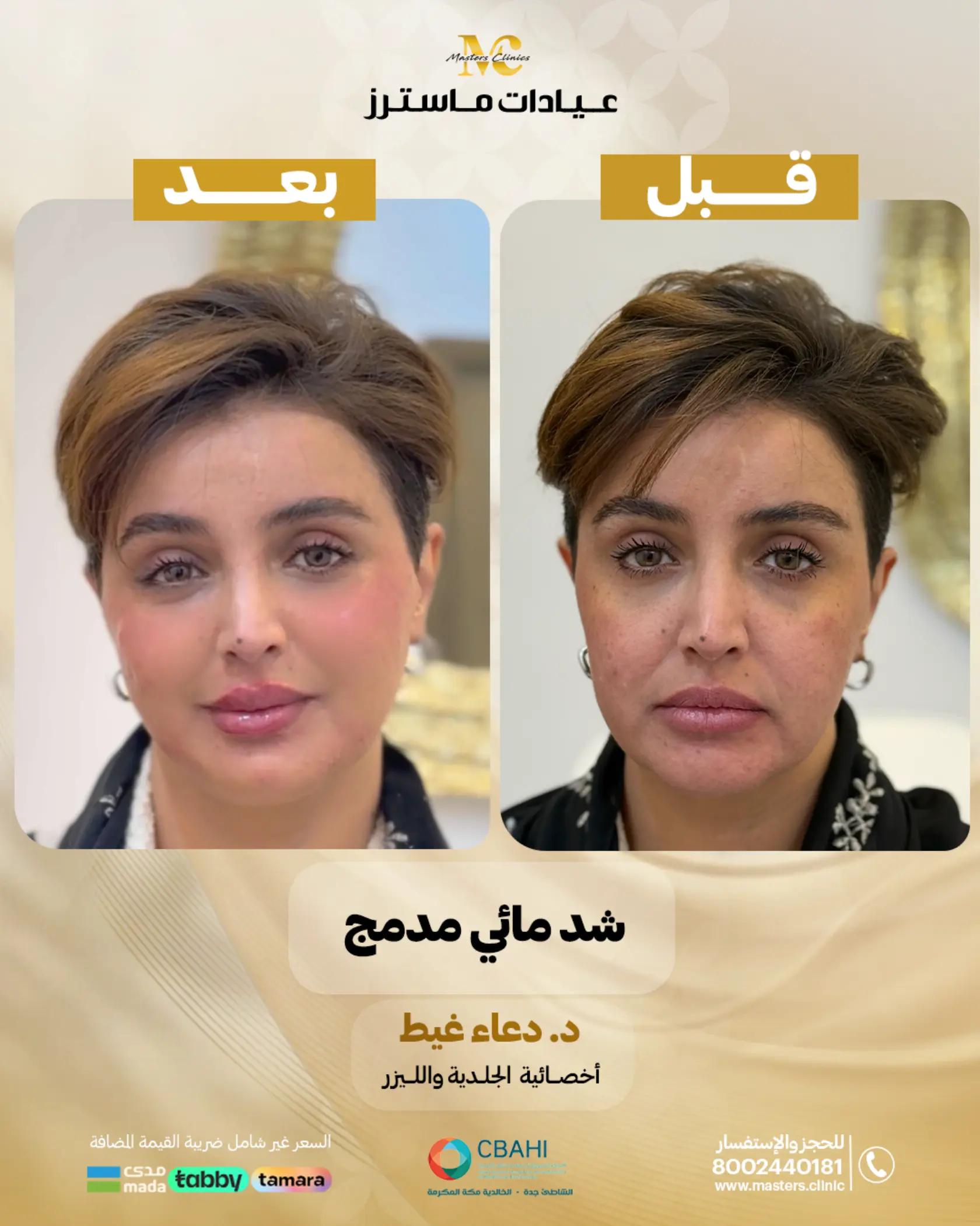 @عيادات ماسترز