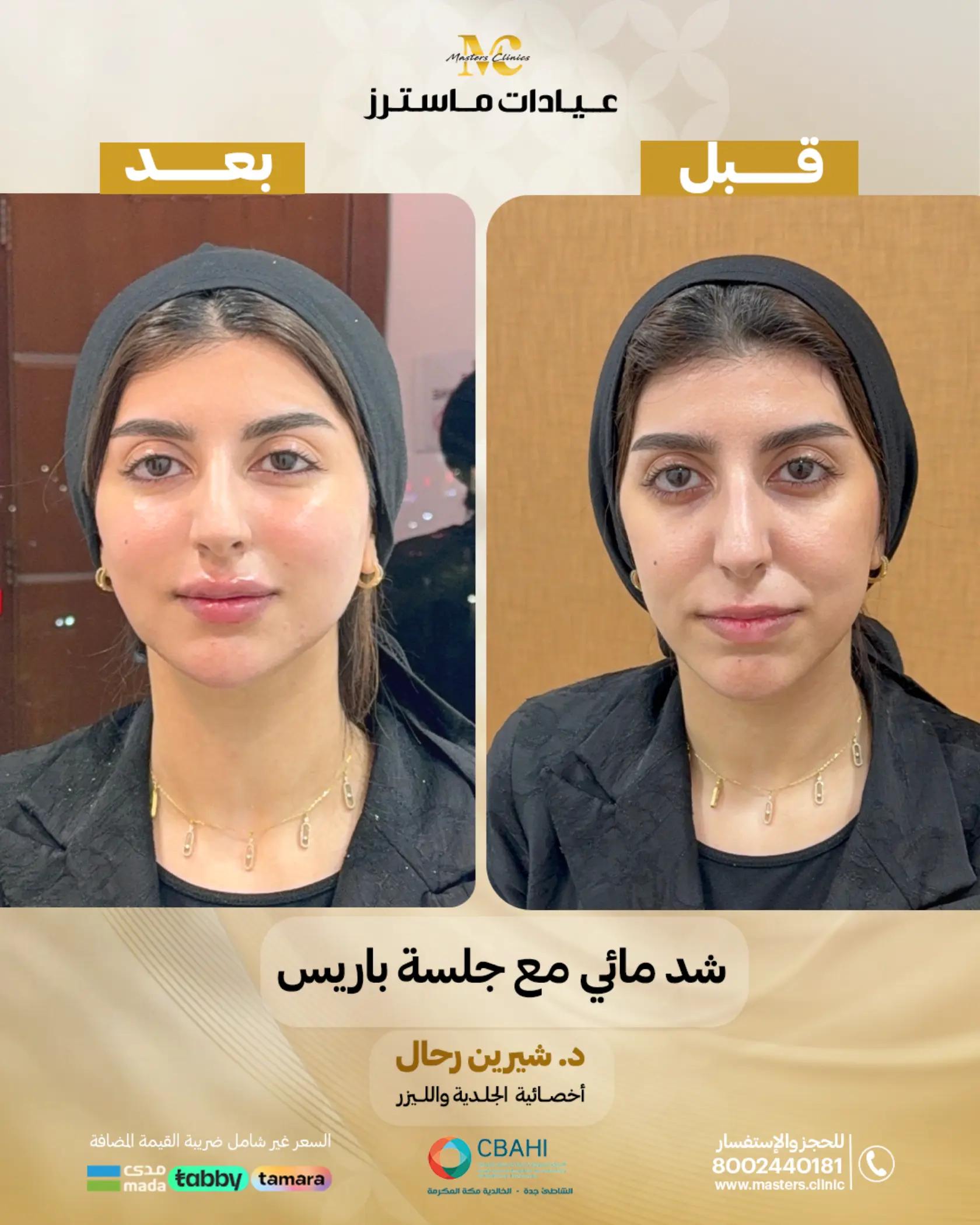 @عيادات ماسترز