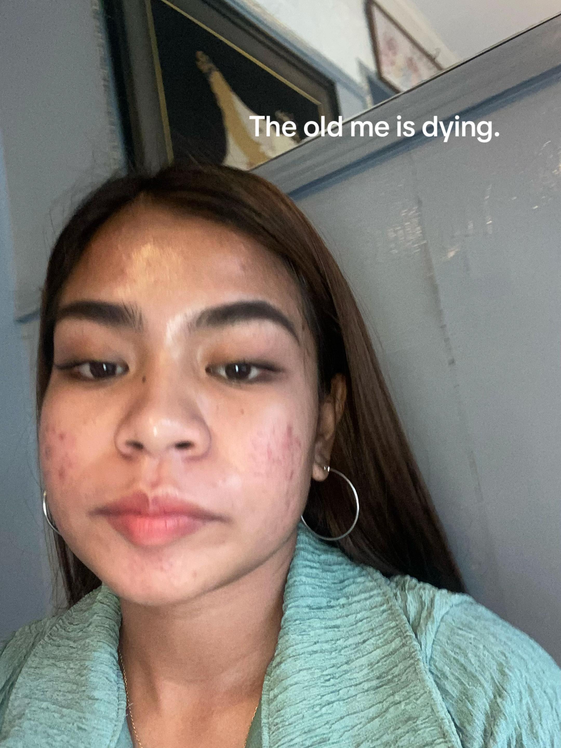 @Vinice Anne