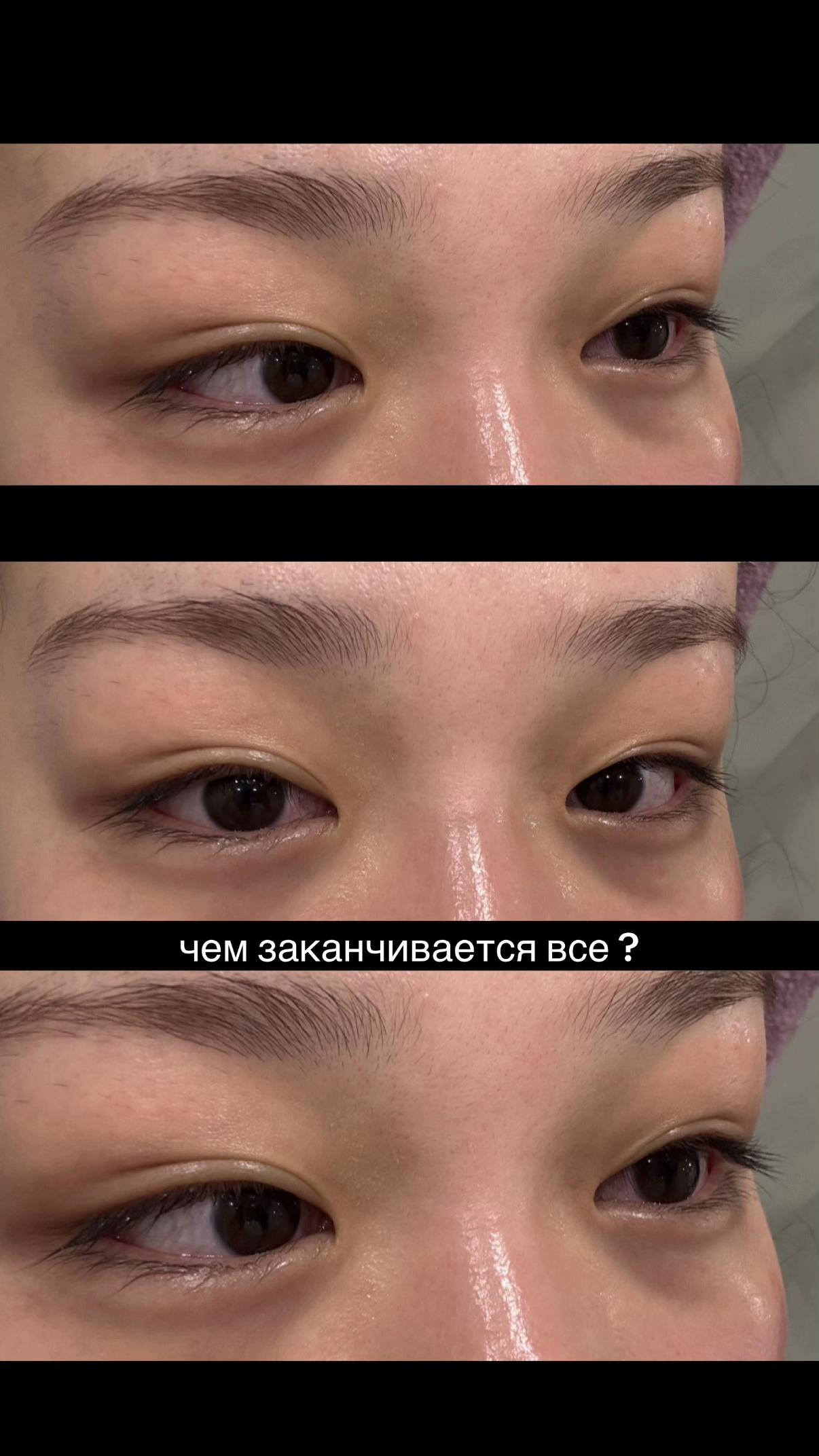 @syll メ’𝟶