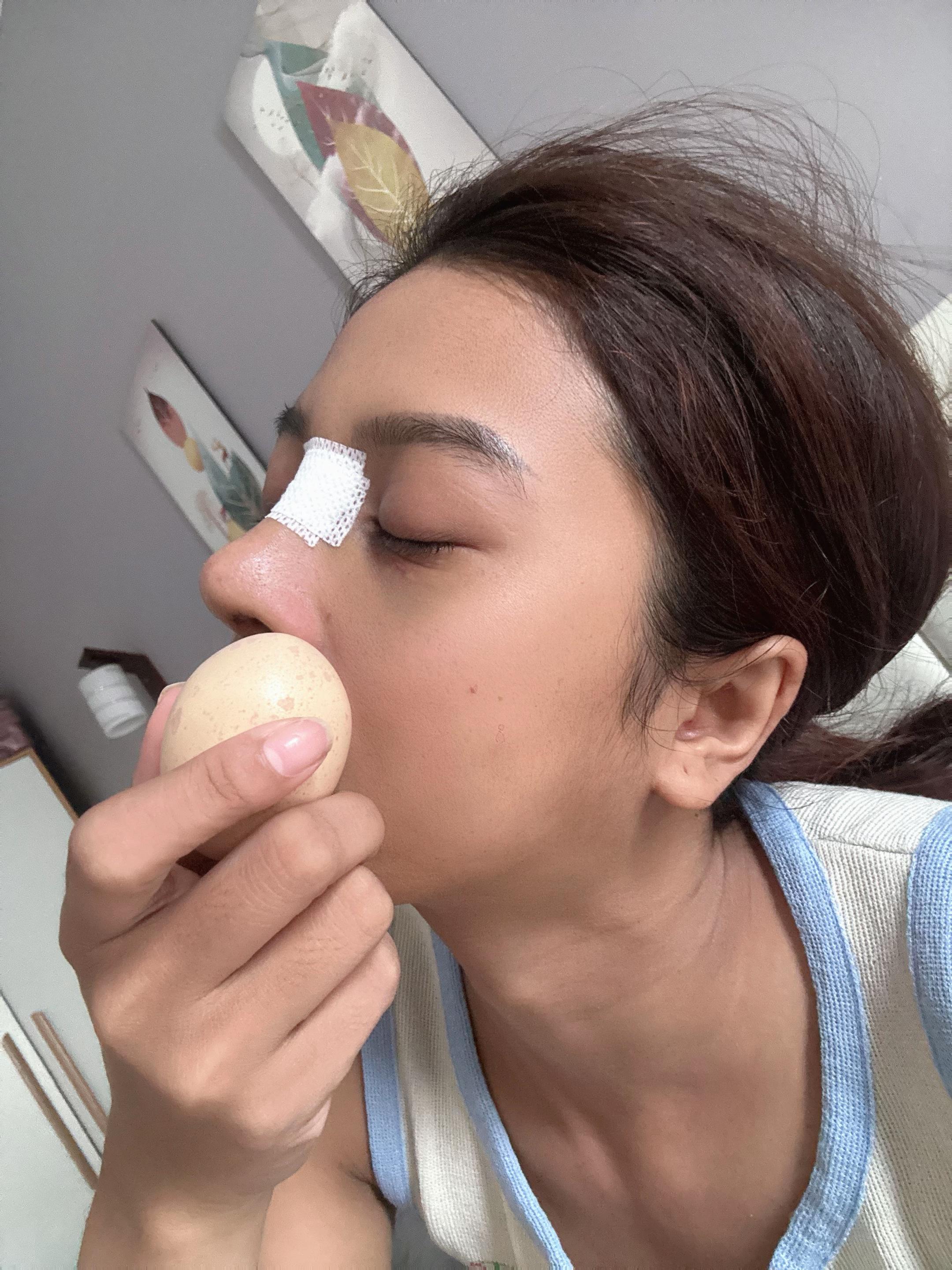 @815 August๐ฐ๐ญ๐จ๐ณ