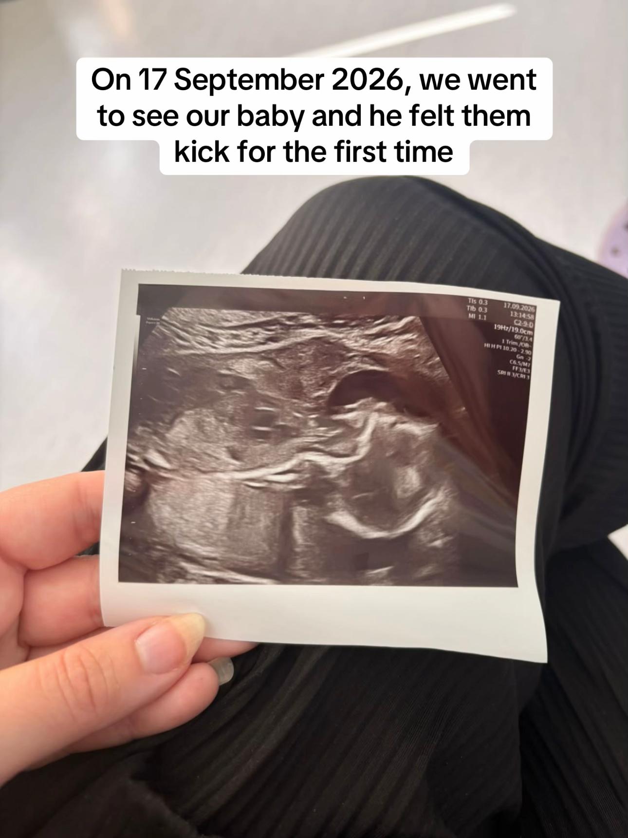@H | pregnancy after loss 💛