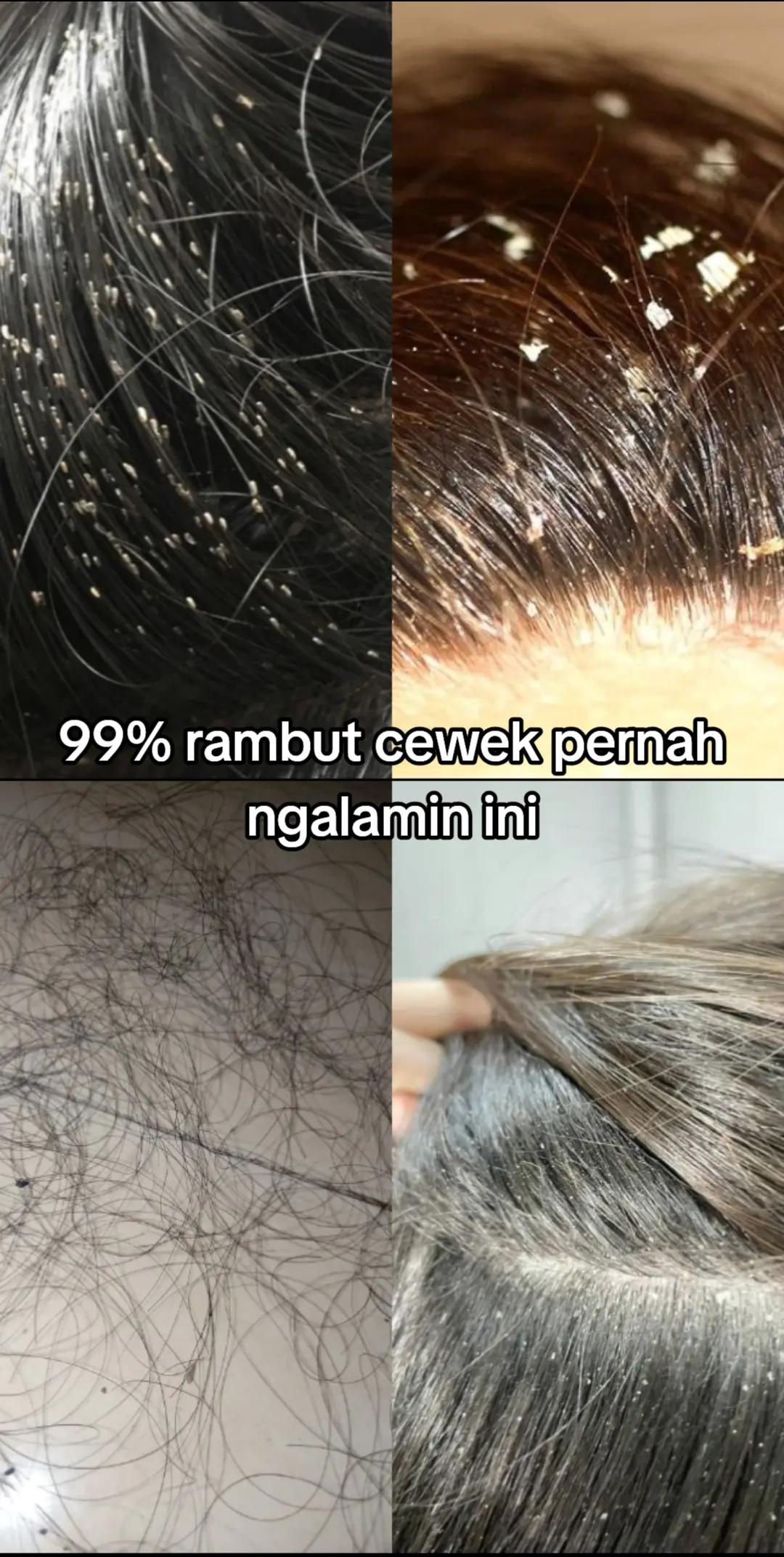 @Random Post