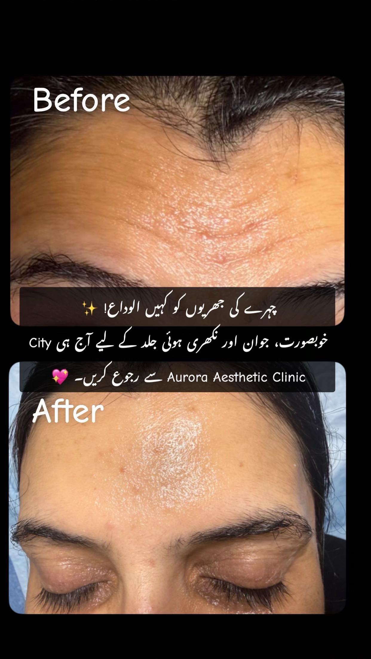 @City Aurora Asthetic clinic