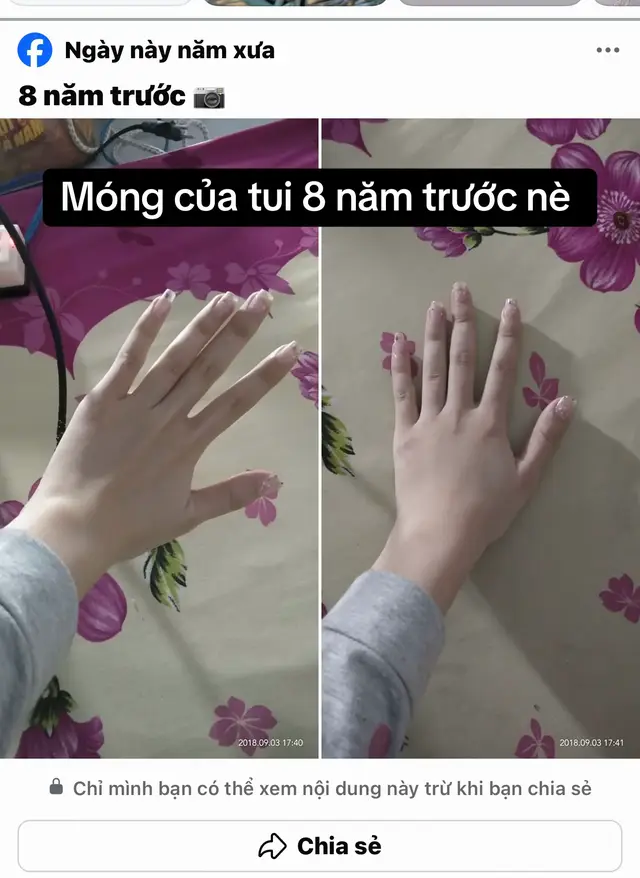 @Dưỡng M&oacute;ng Tuyền Nguyễn ✅