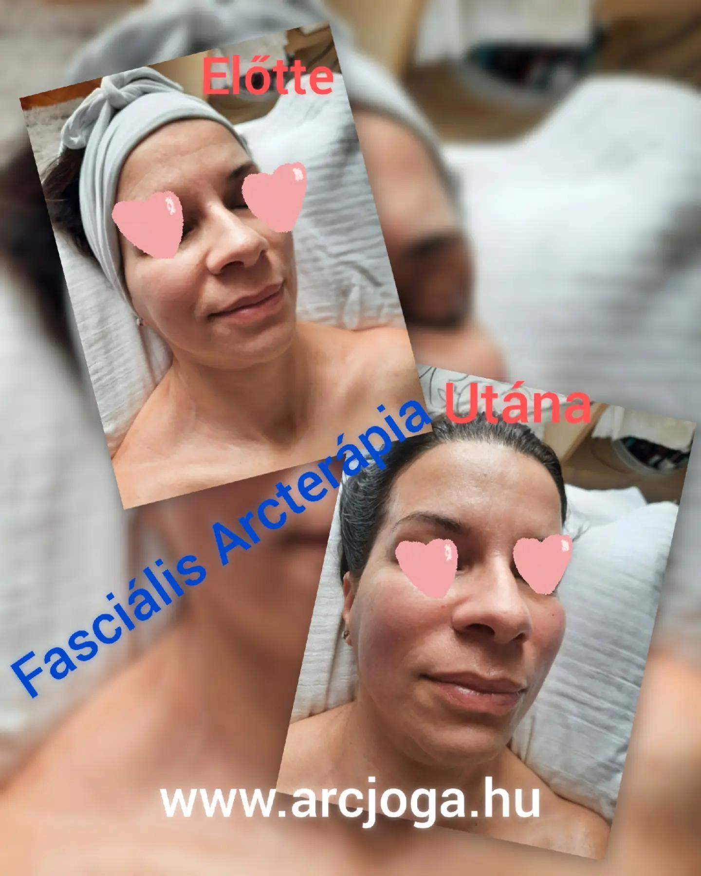 @Koós Viki