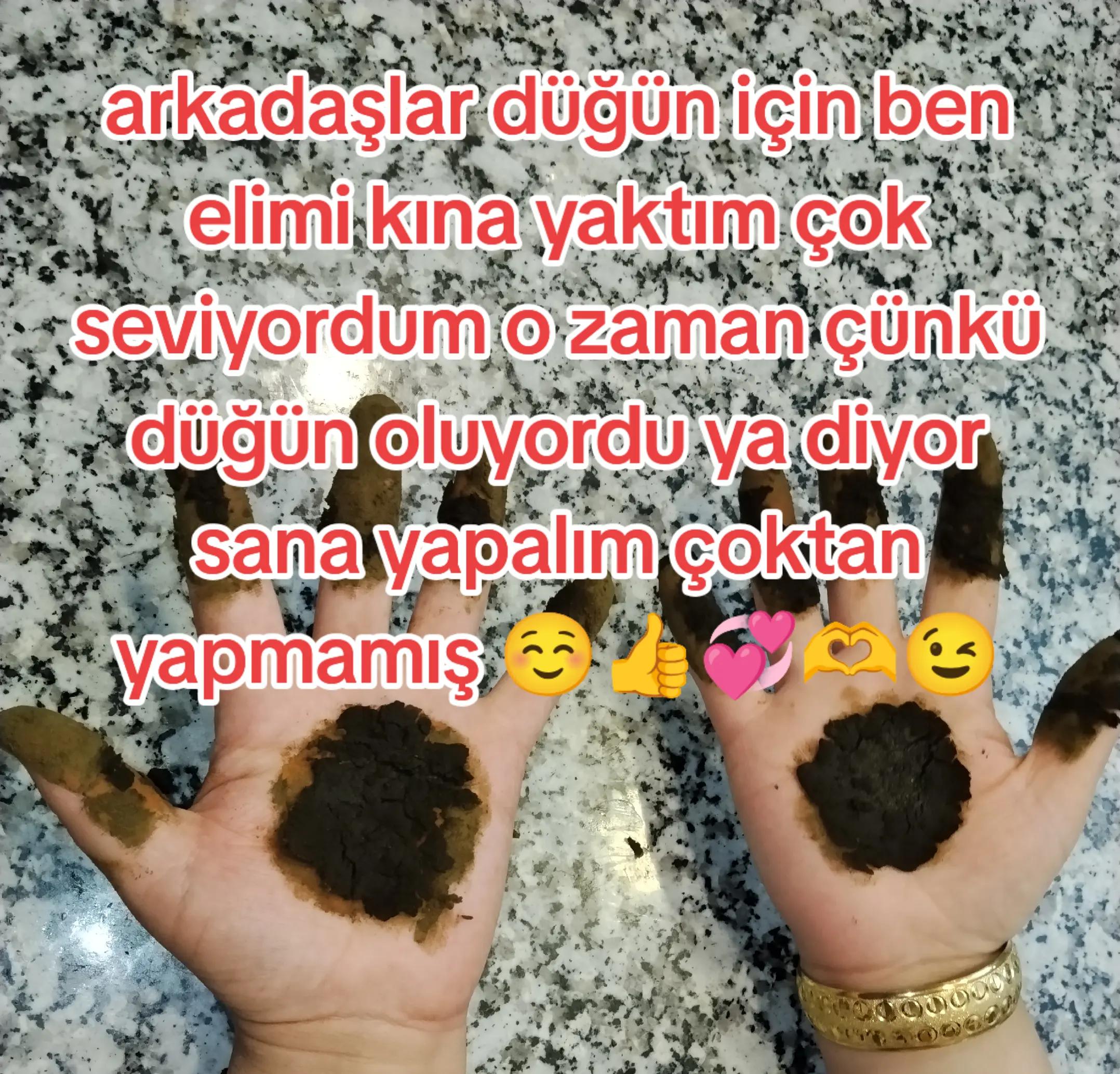 @Ronayi
