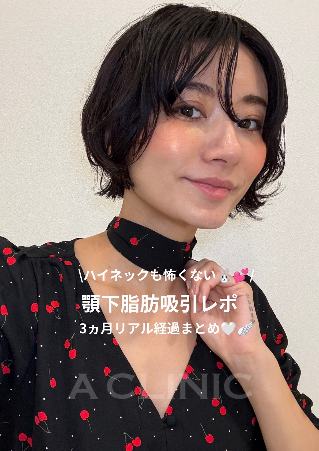 @ACLINIC池袋院【小顔/中顔面短縮】