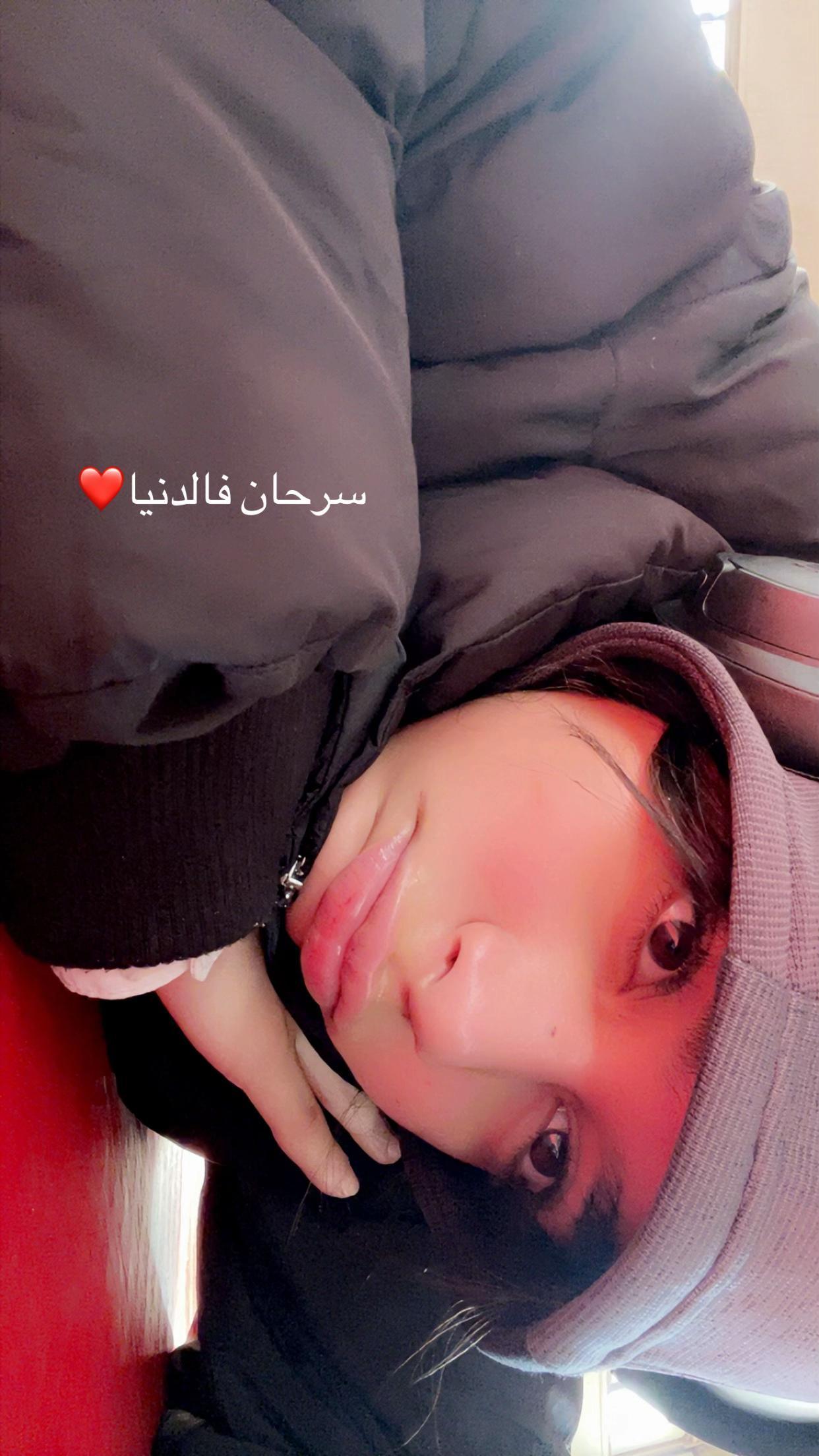 @Hanin44