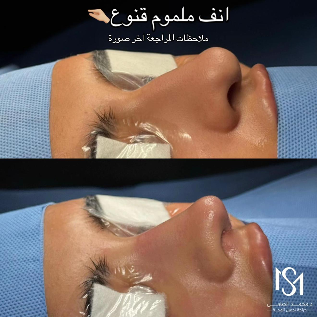 @د. محمد الصامل