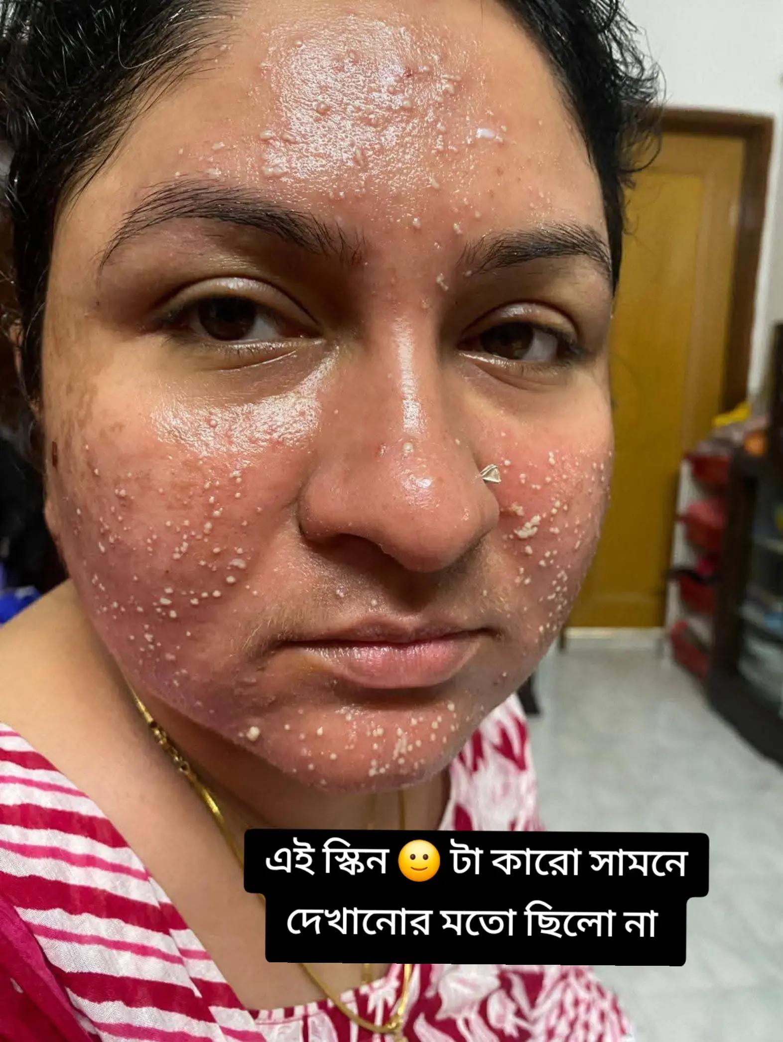 @Shebis skin care